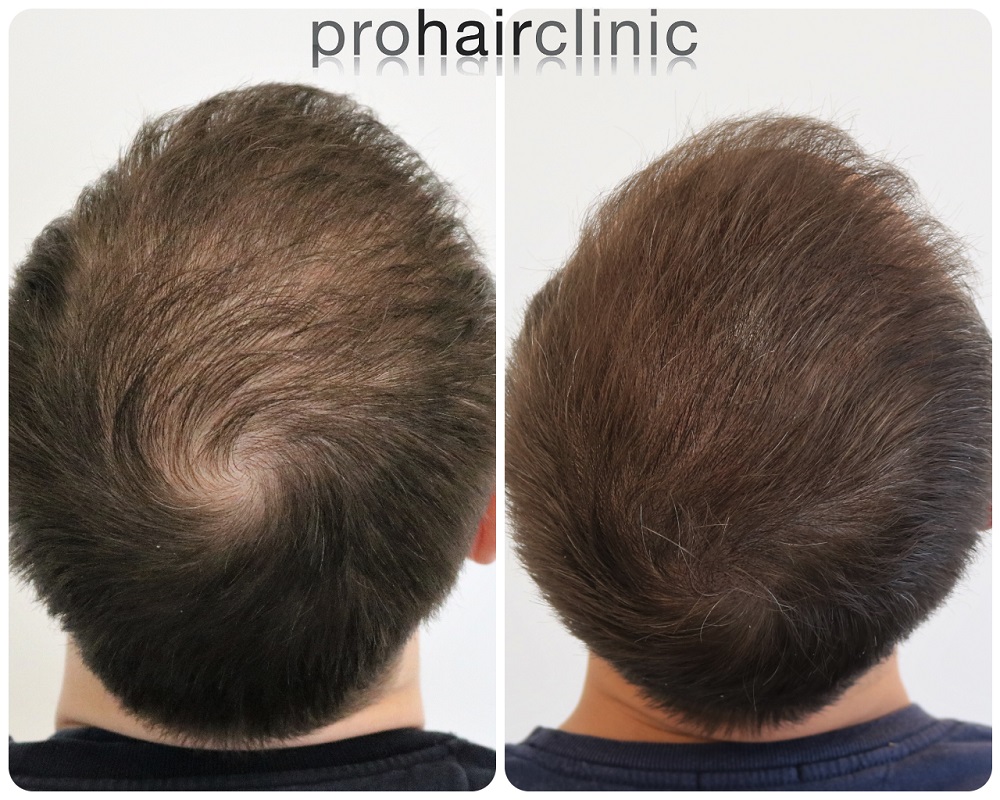 /foren/transplant/index.php/fa/55499/0/