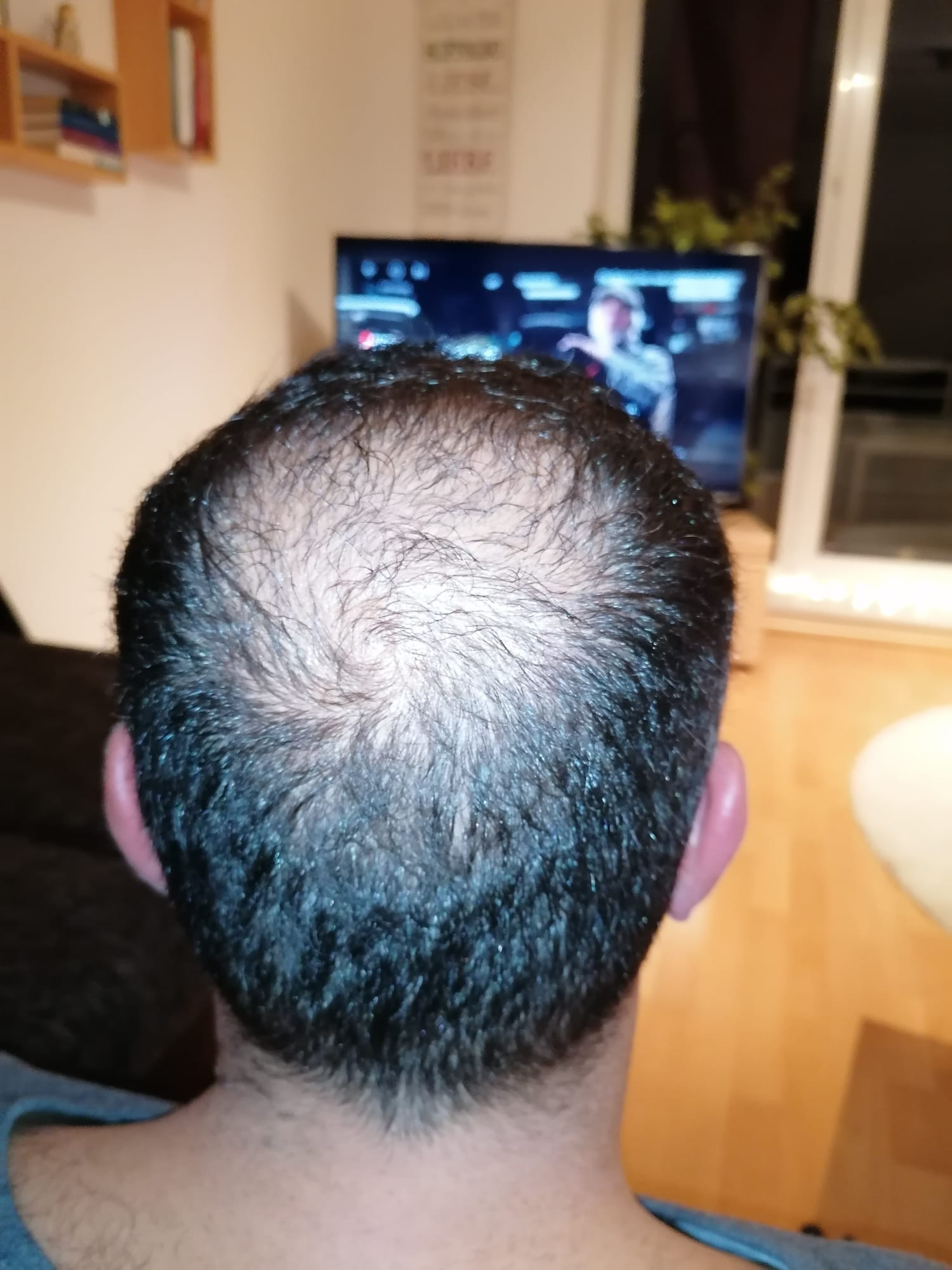 /foren/transplant/index.php/fa/55561/0/