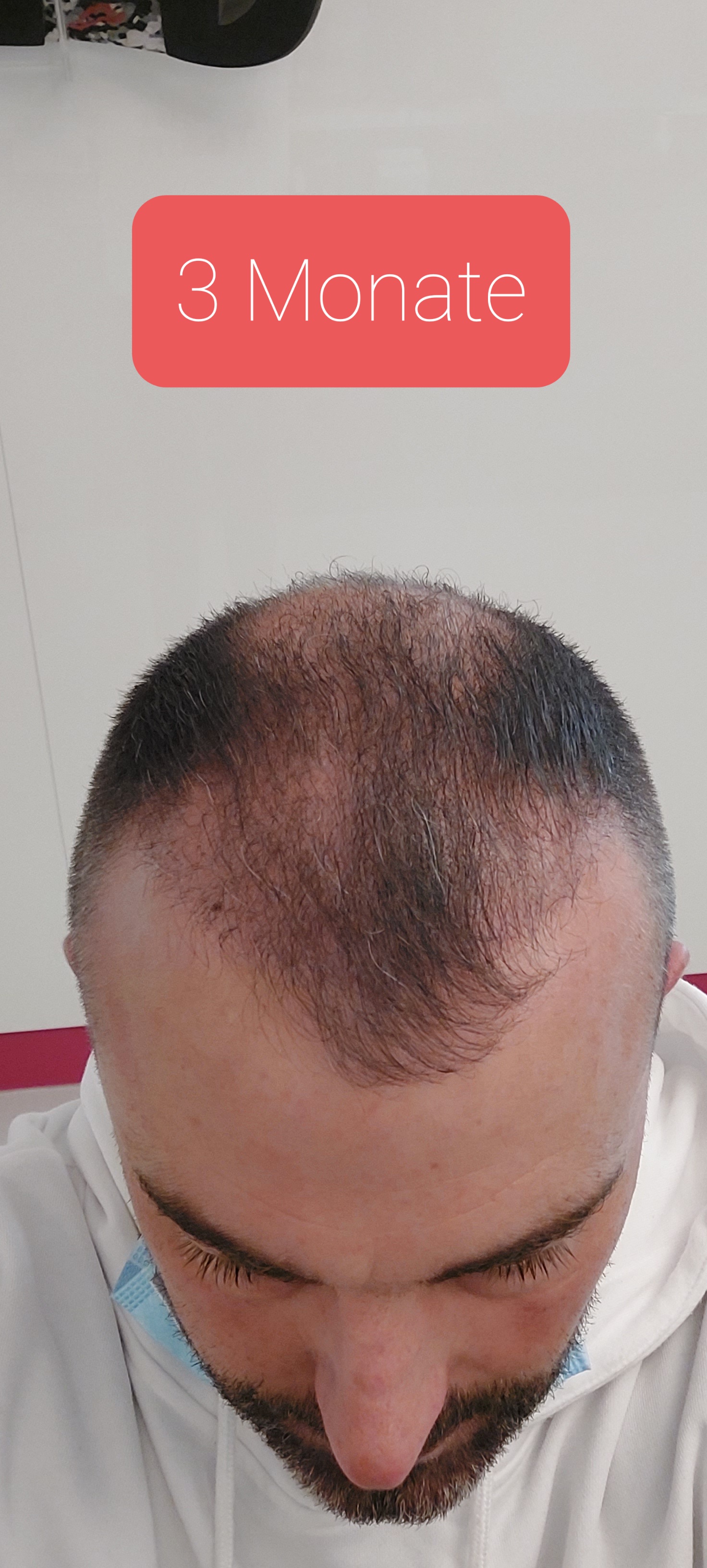 /foren/transplant/index.php/fa/55629/0/