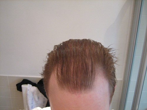 index.php/fa/5570/0/