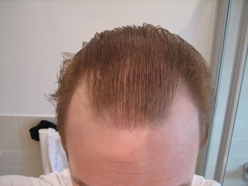 index.php/fa/5571/0/