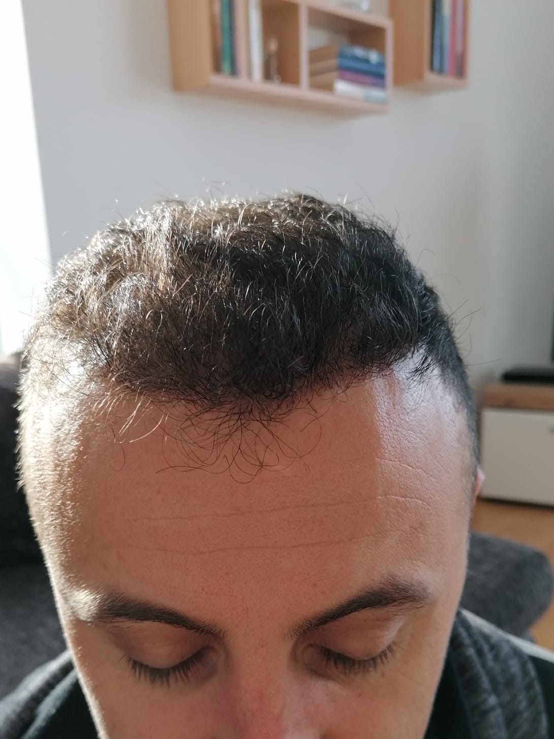 /foren/transplant/index.php/fa/55721/0/