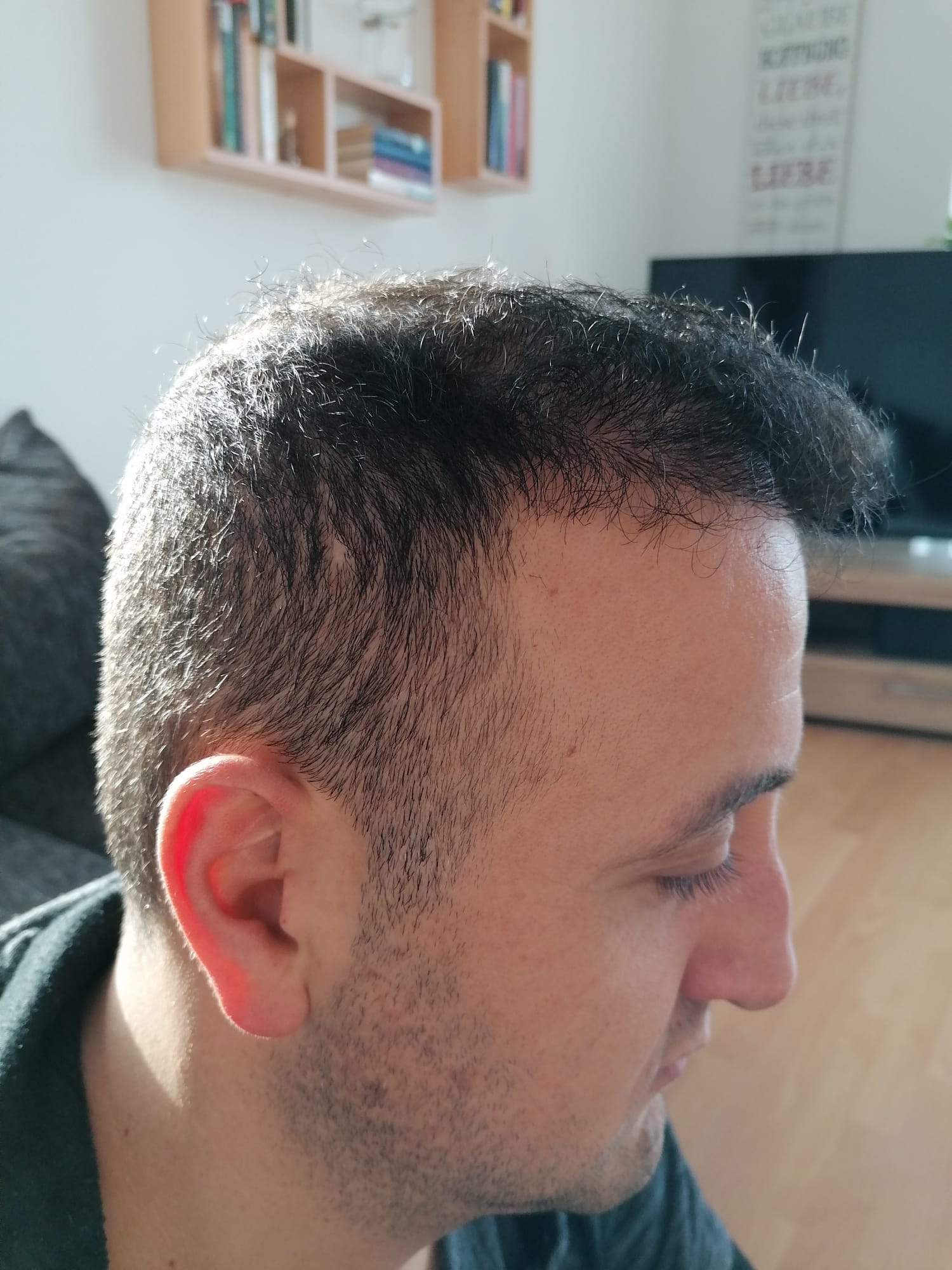 /foren/transplant/index.php/fa/55722/0/