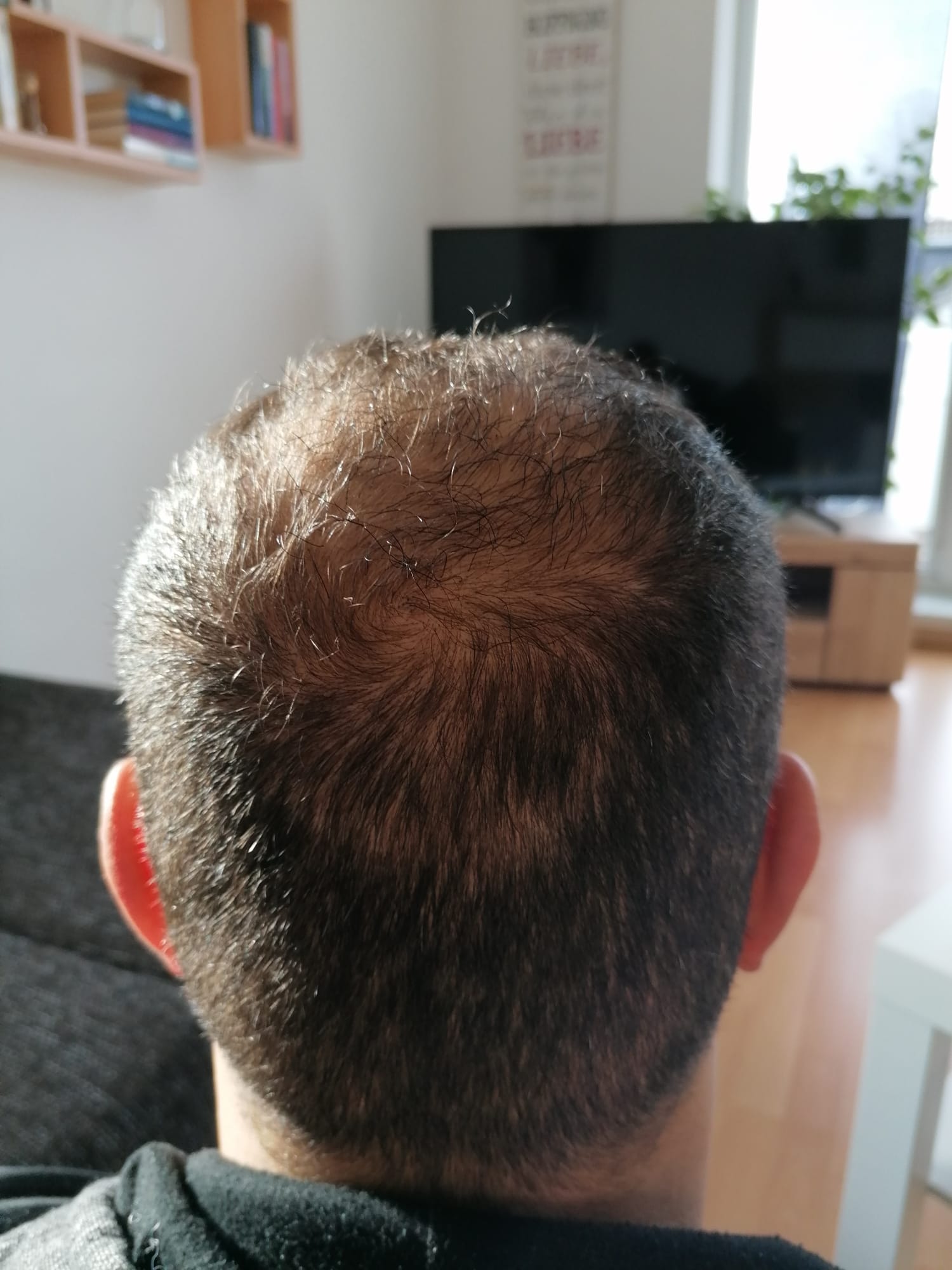 /foren/transplant/index.php/fa/55723/0/