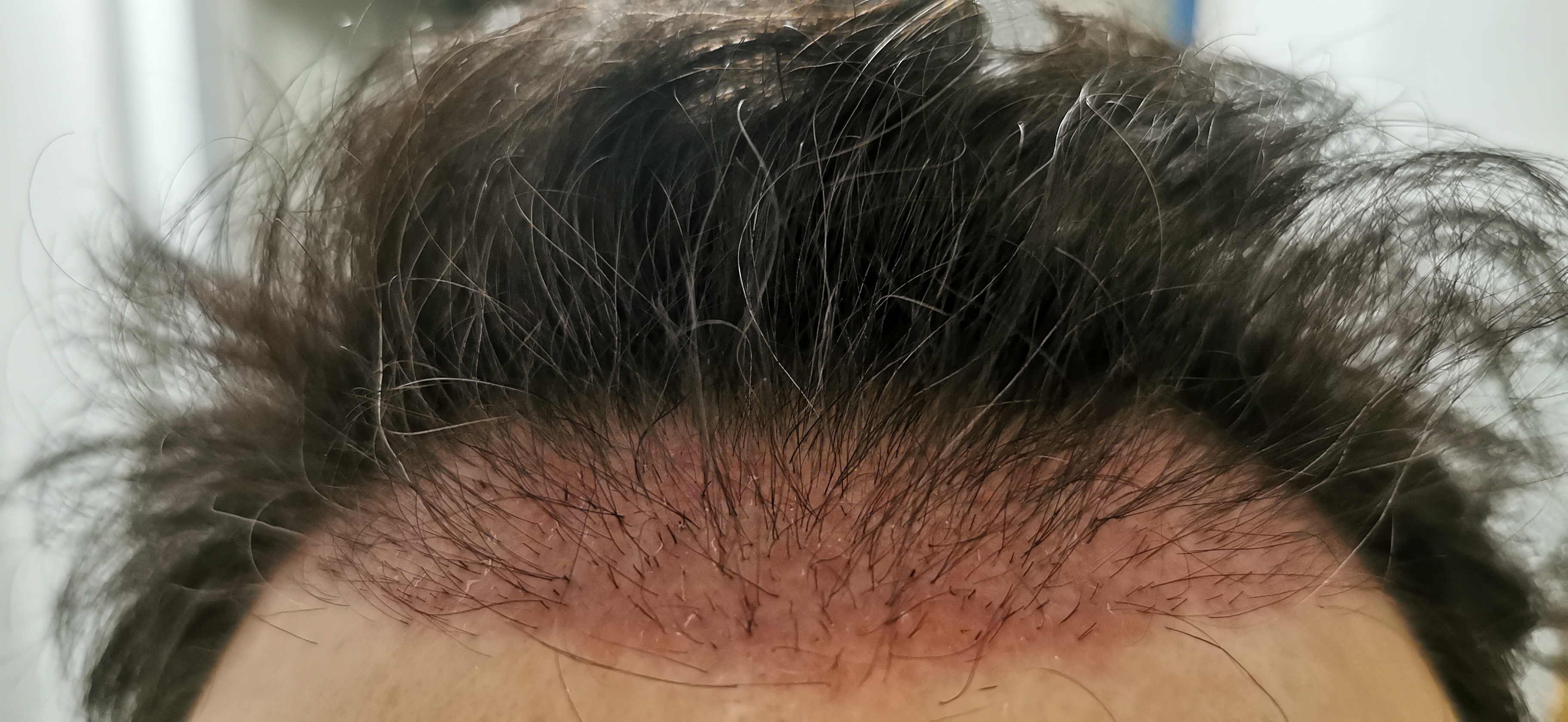 /foren/transplant/index.php/fa/55885/0/