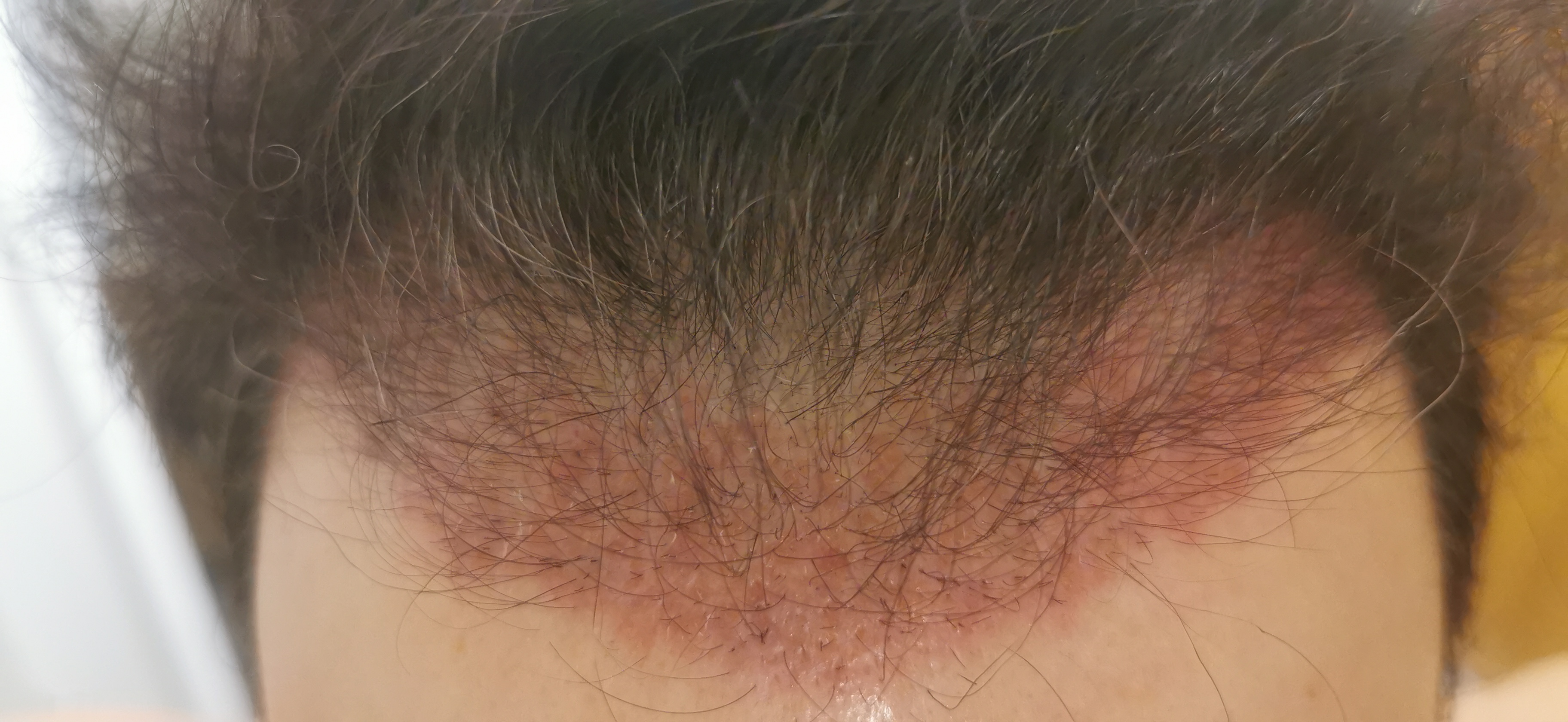 /foren/transplant/index.php/fa/55886/0/