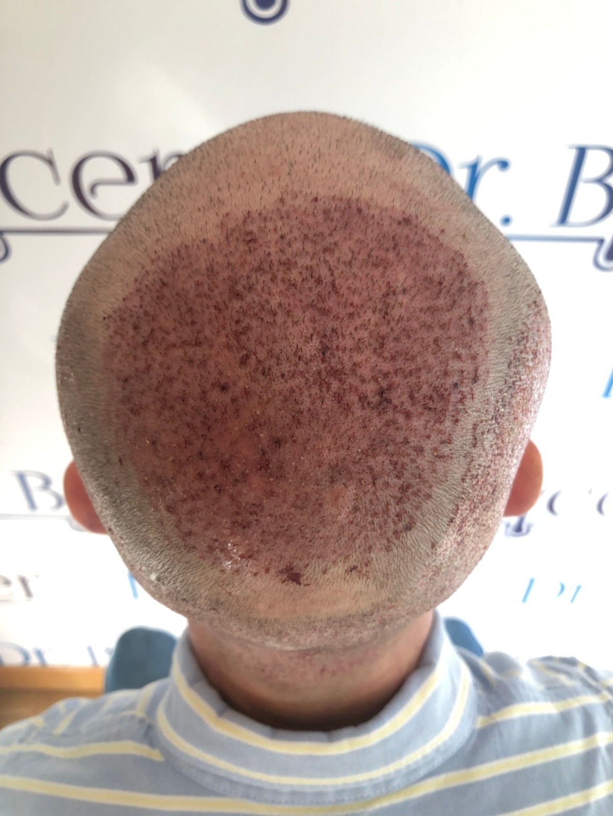 /foren/transplant/index.php/fa/56014/0/