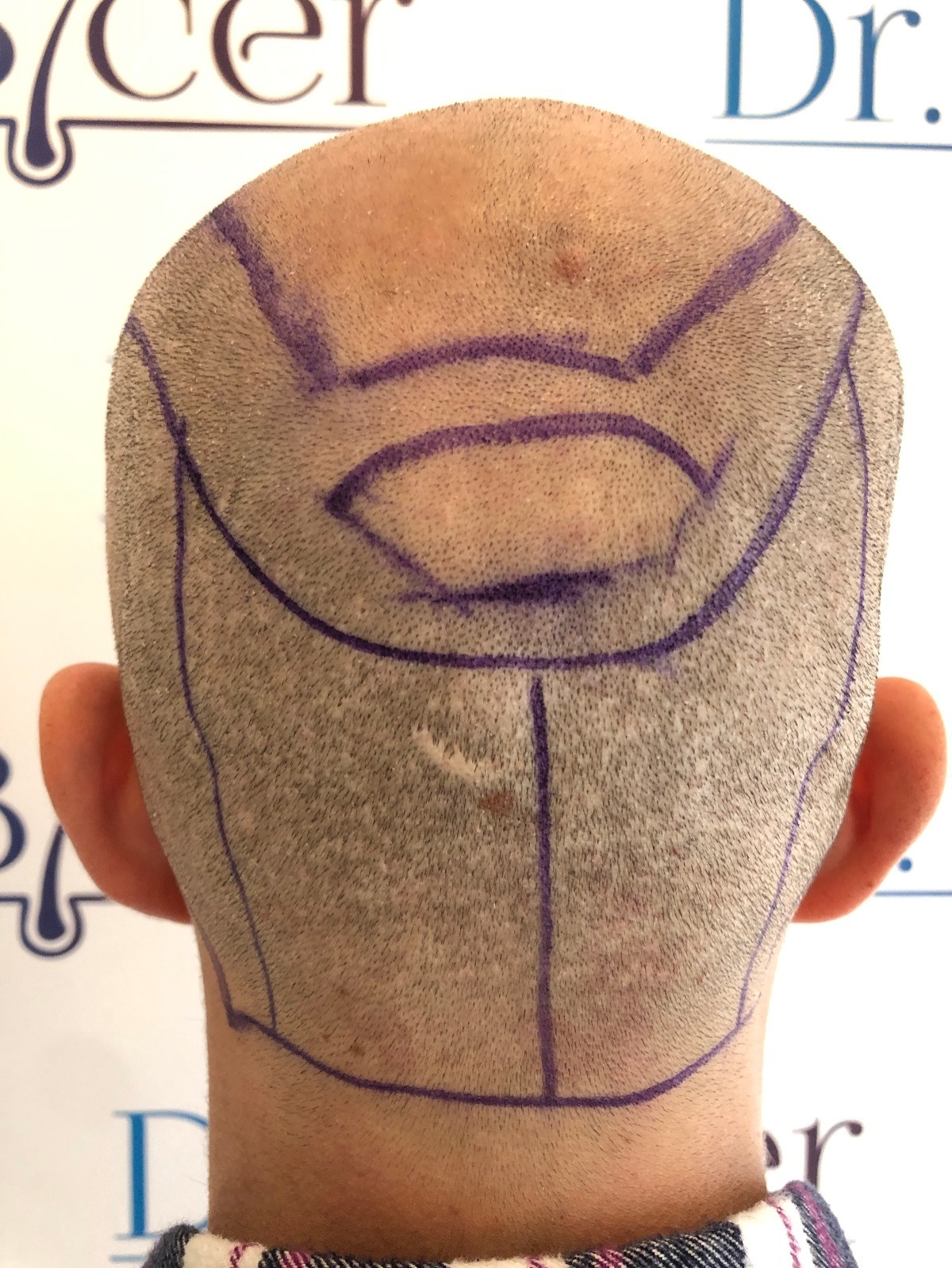 /foren/transplant/index.php/fa/56015/0/