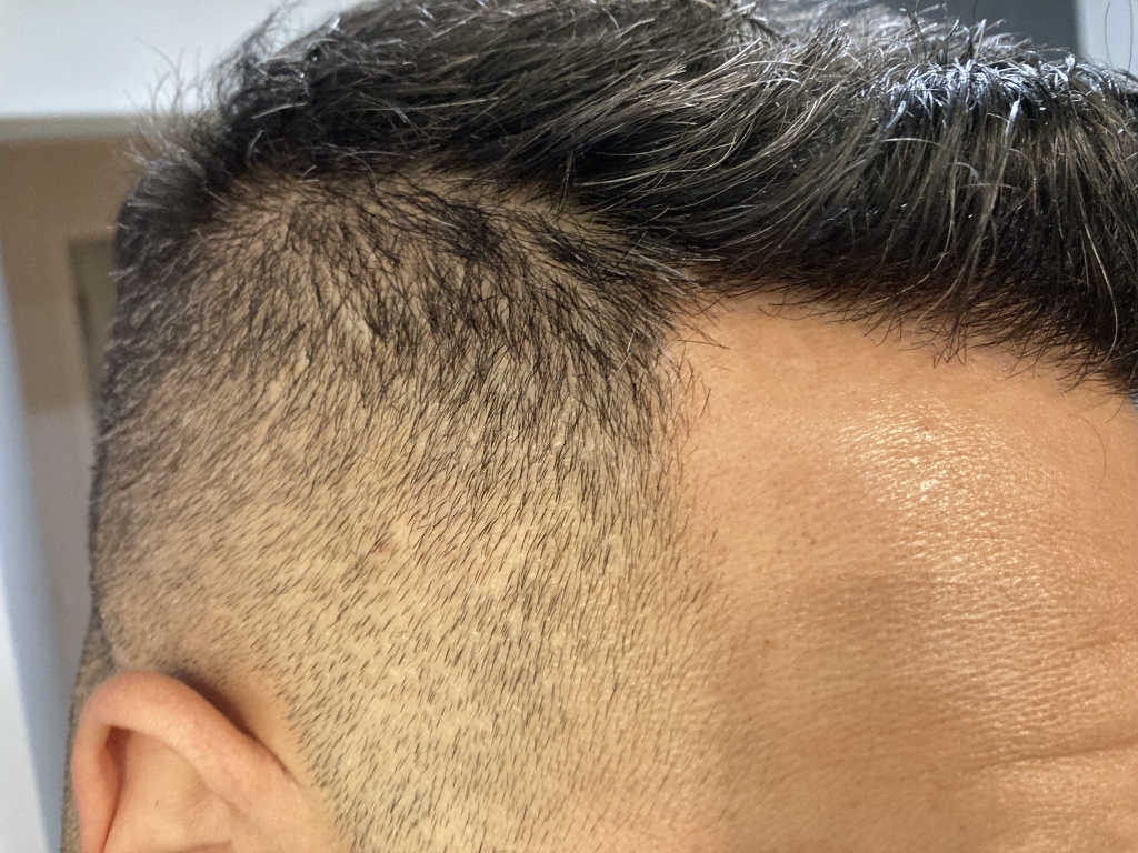 /foren/transplant/index.php/fa/56053/0/