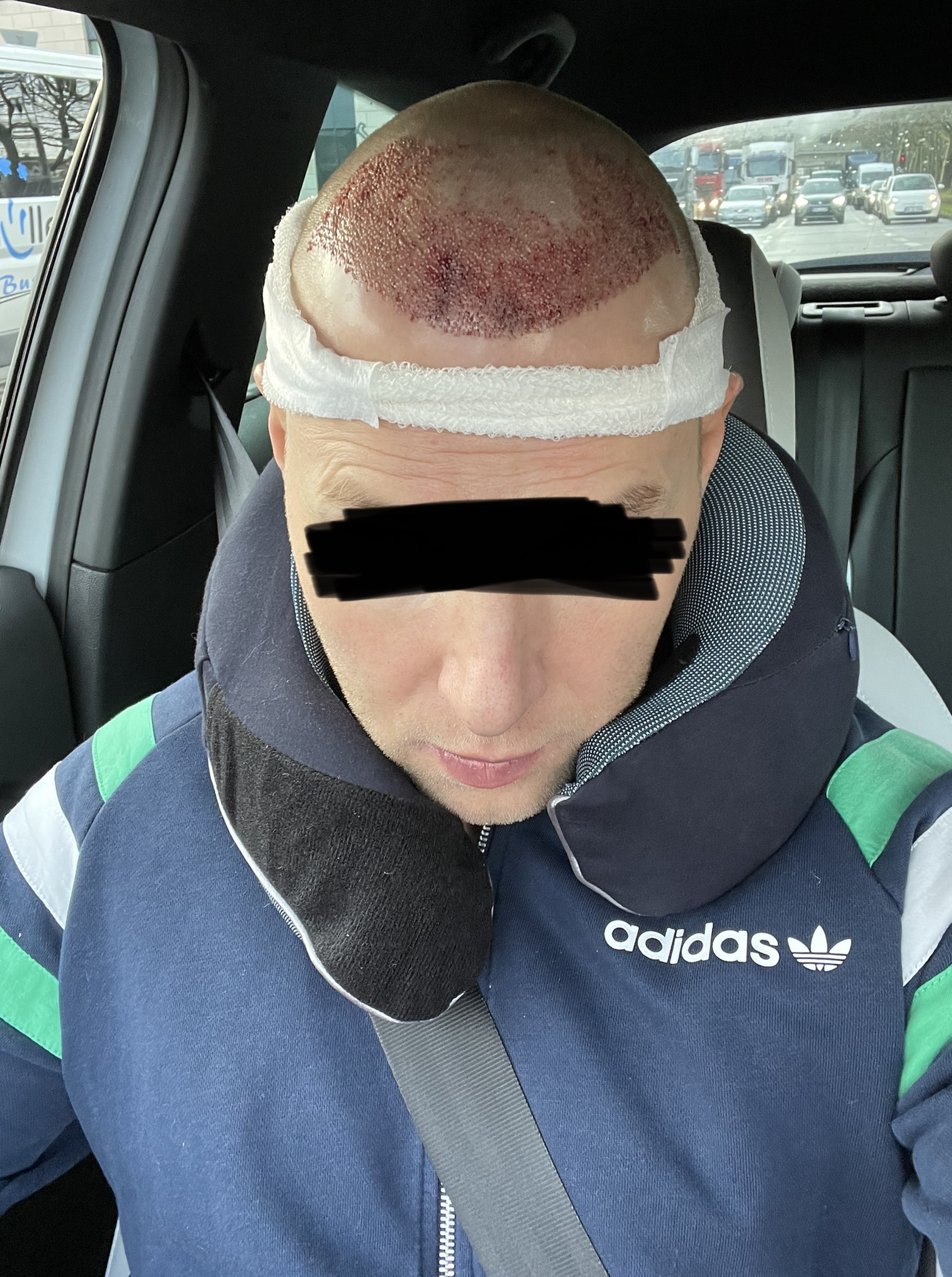 /foren/transplant/index.php/fa/56074/0/