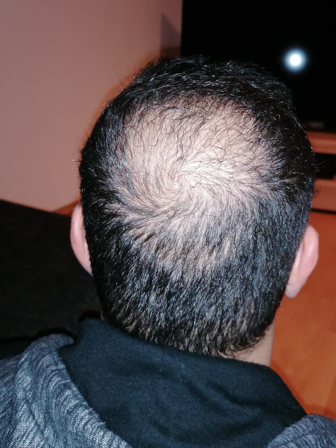 /foren/transplant/index.php/fa/56080/0/