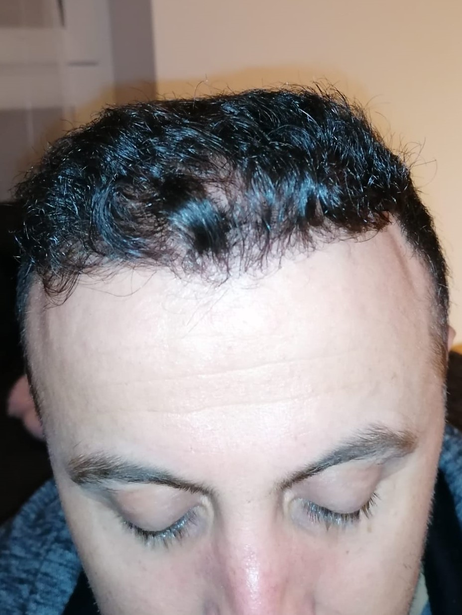 /foren/transplant/index.php/fa/56082/0/