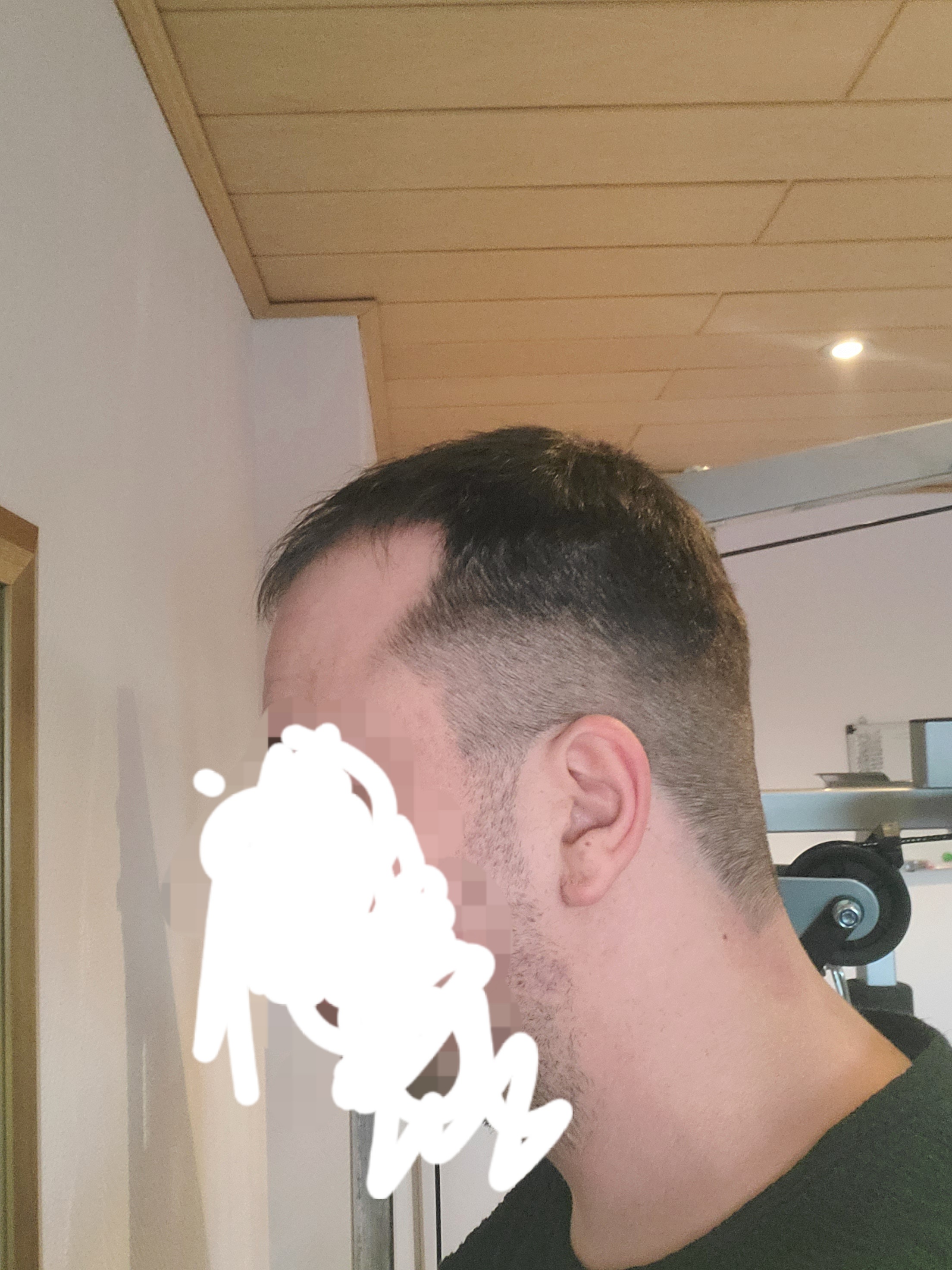 /foren/transplant/index.php/fa/56094/0/