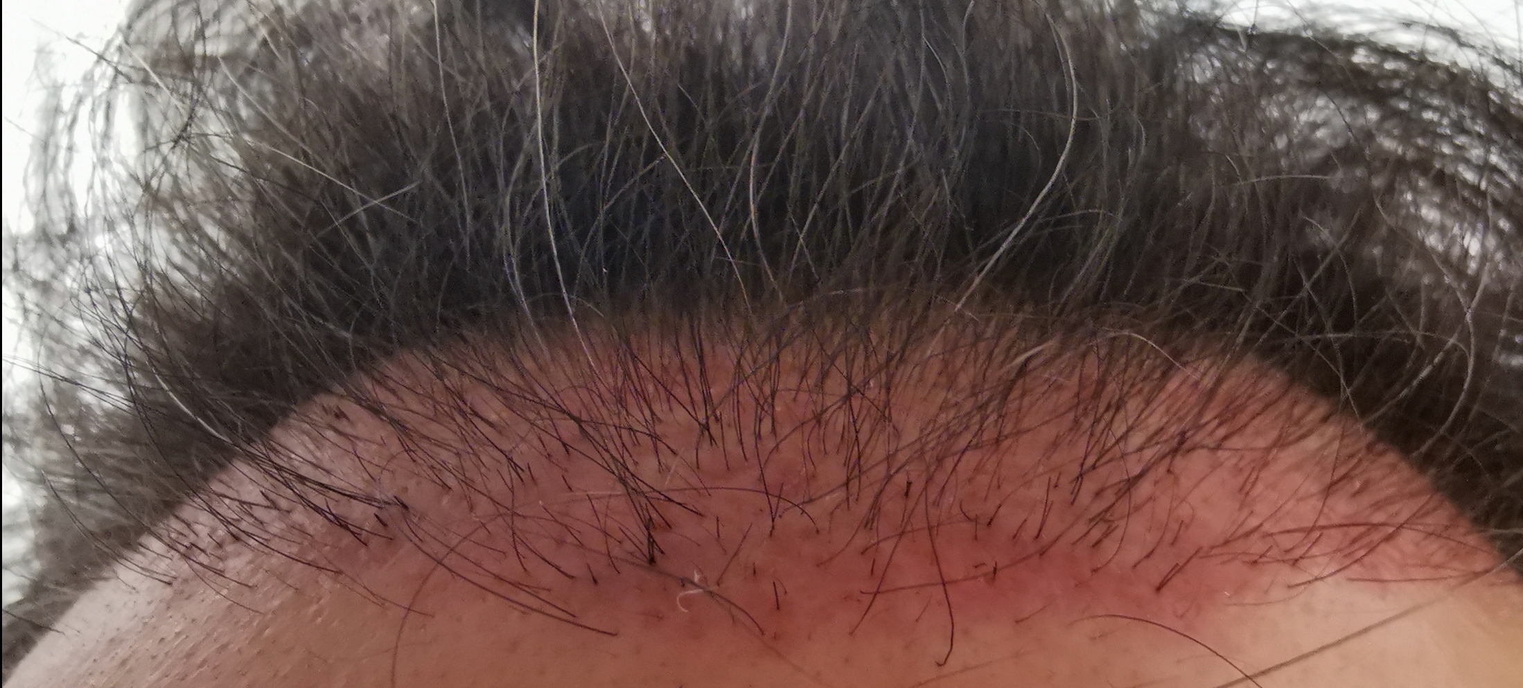 /foren/transplant/index.php/fa/56096/0/