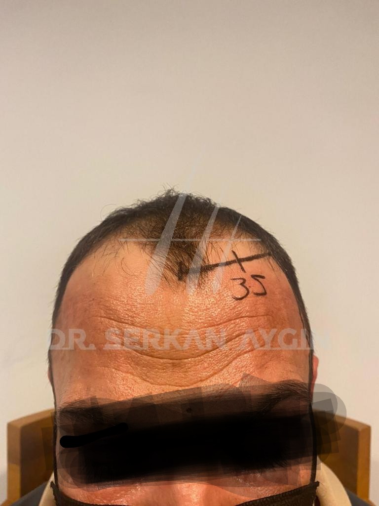 /foren/transplant/index.php/fa/56165/0/