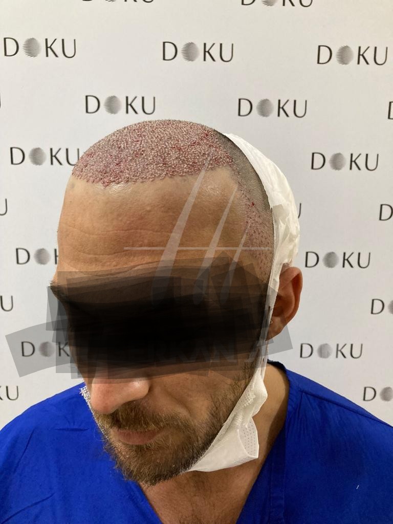 /foren/transplant/index.php/fa/56166/0/