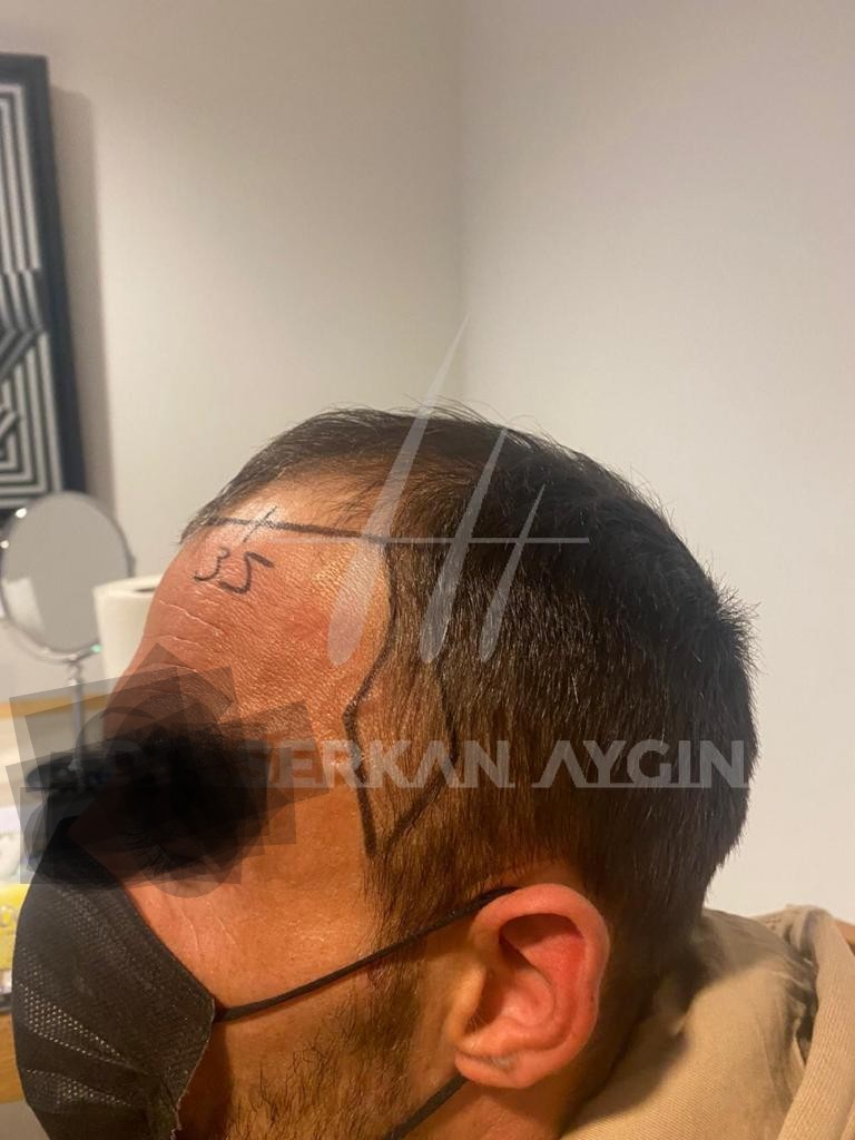 /foren/transplant/index.php/fa/56167/0/