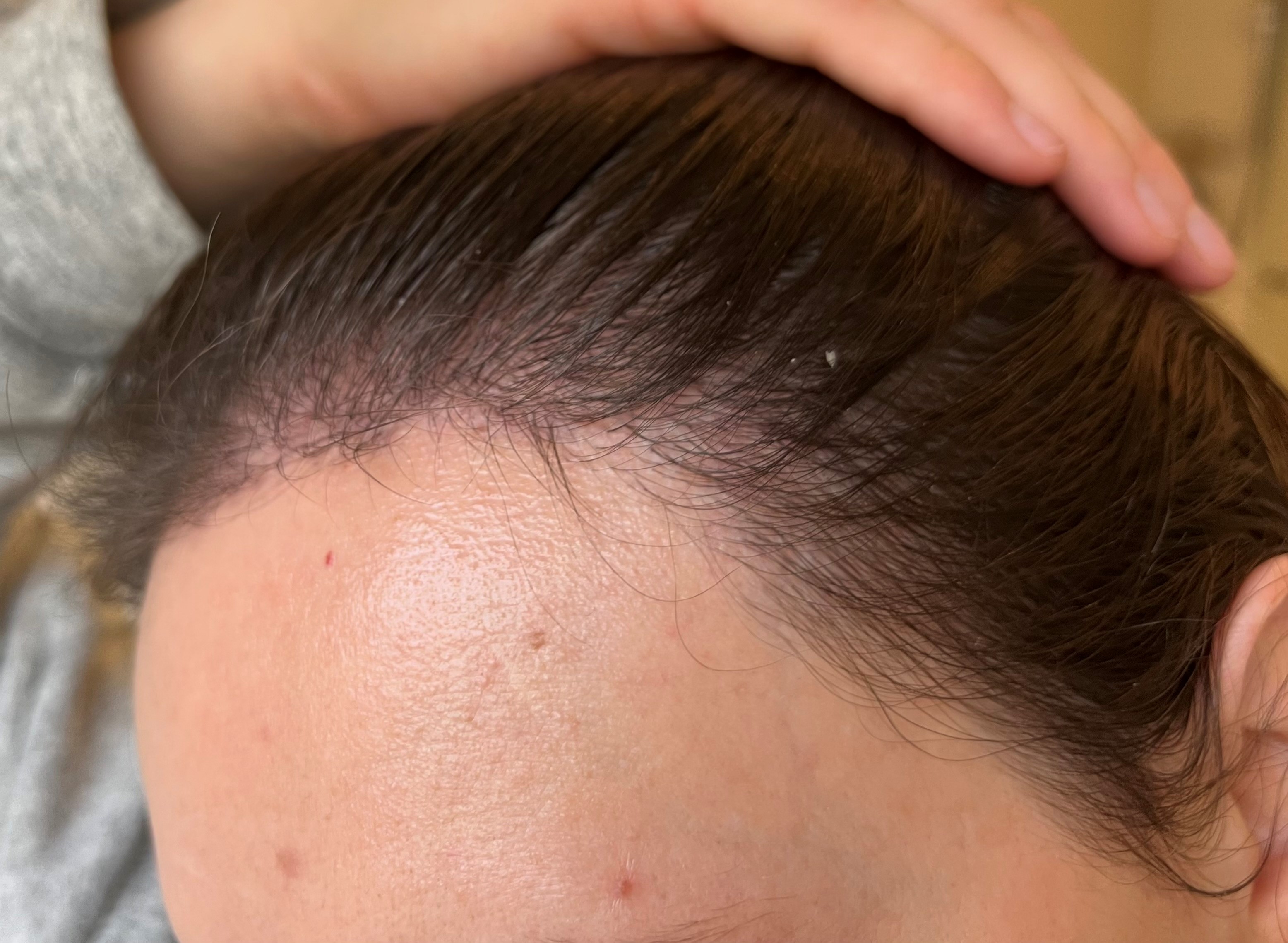 /foren/transplant/index.php/fa/56181/0/