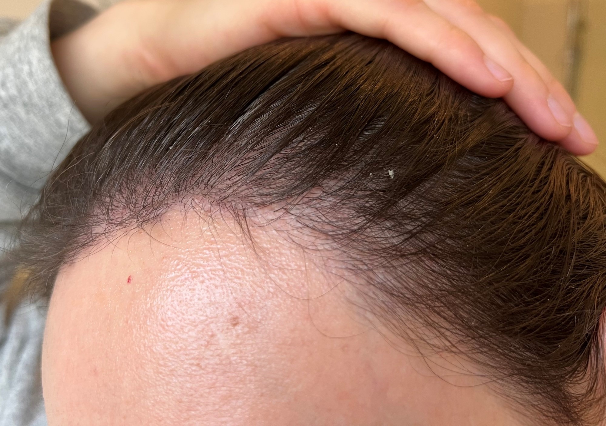 /foren/transplant/index.php/fa/56182/0/