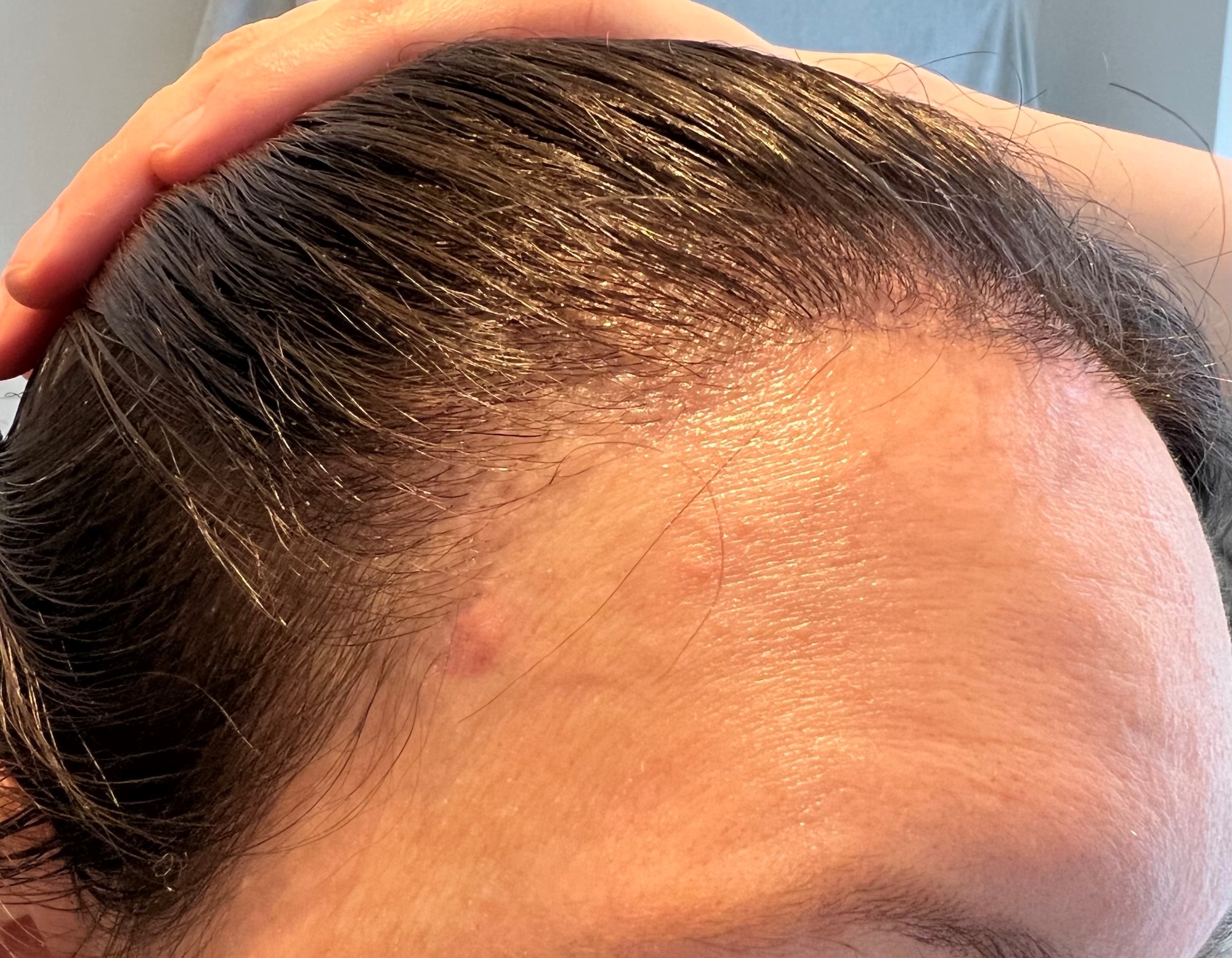 /foren/transplant/index.php/fa/56183/0/