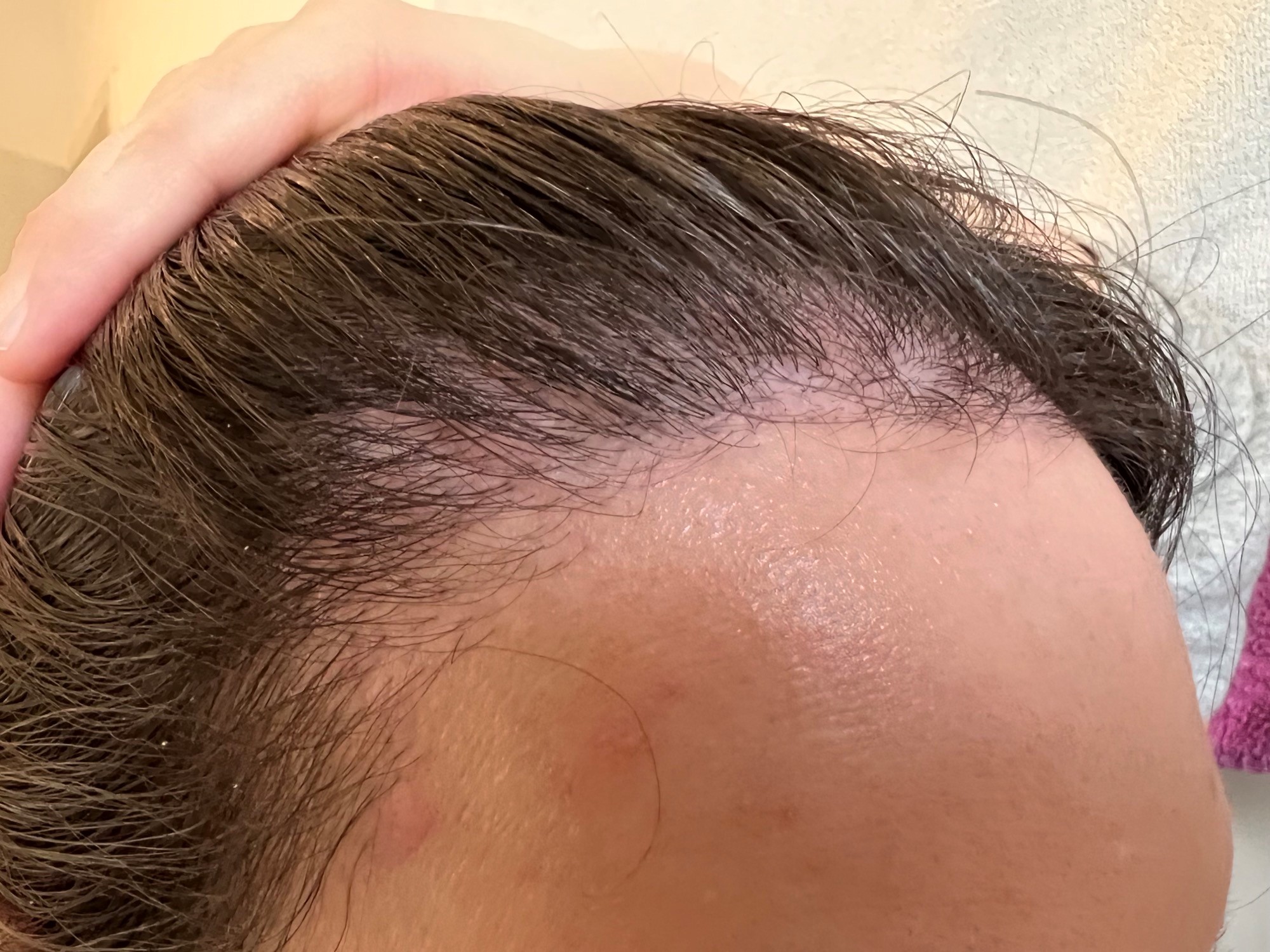 /foren/transplant/index.php/fa/56184/0/