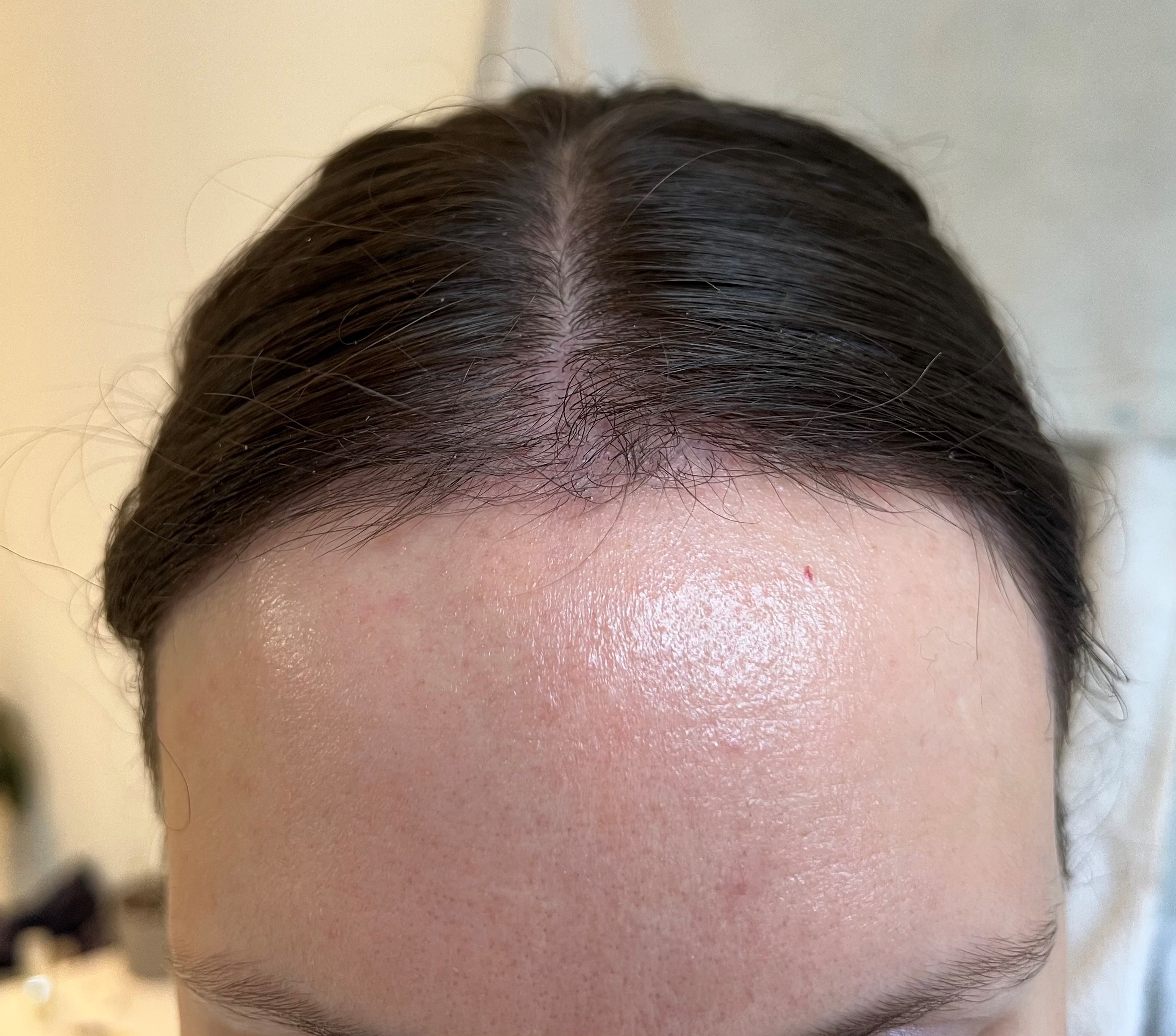 /foren/transplant/index.php/fa/56186/0/