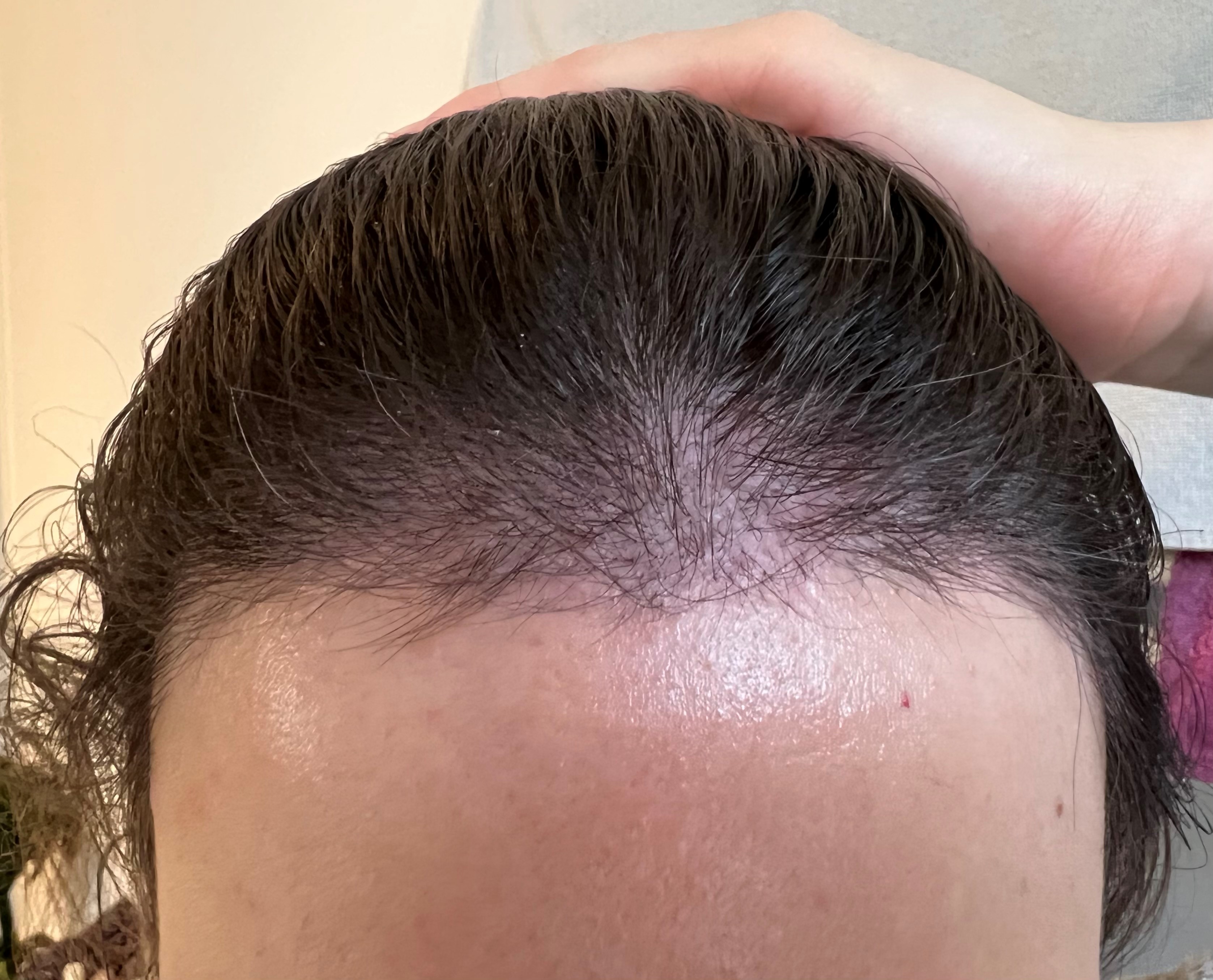 /foren/transplant/index.php/fa/56187/0/