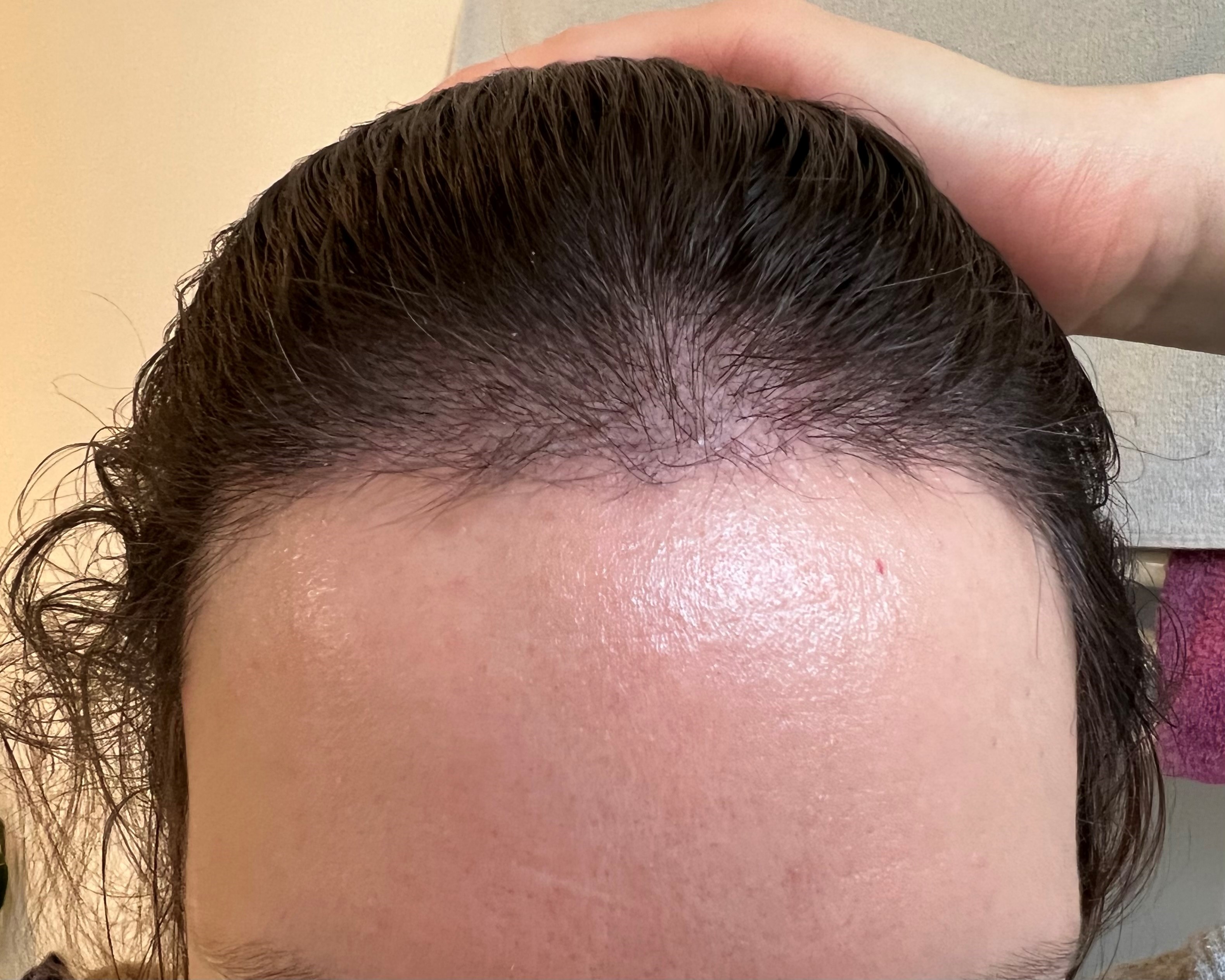 /foren/transplant/index.php/fa/56188/0/