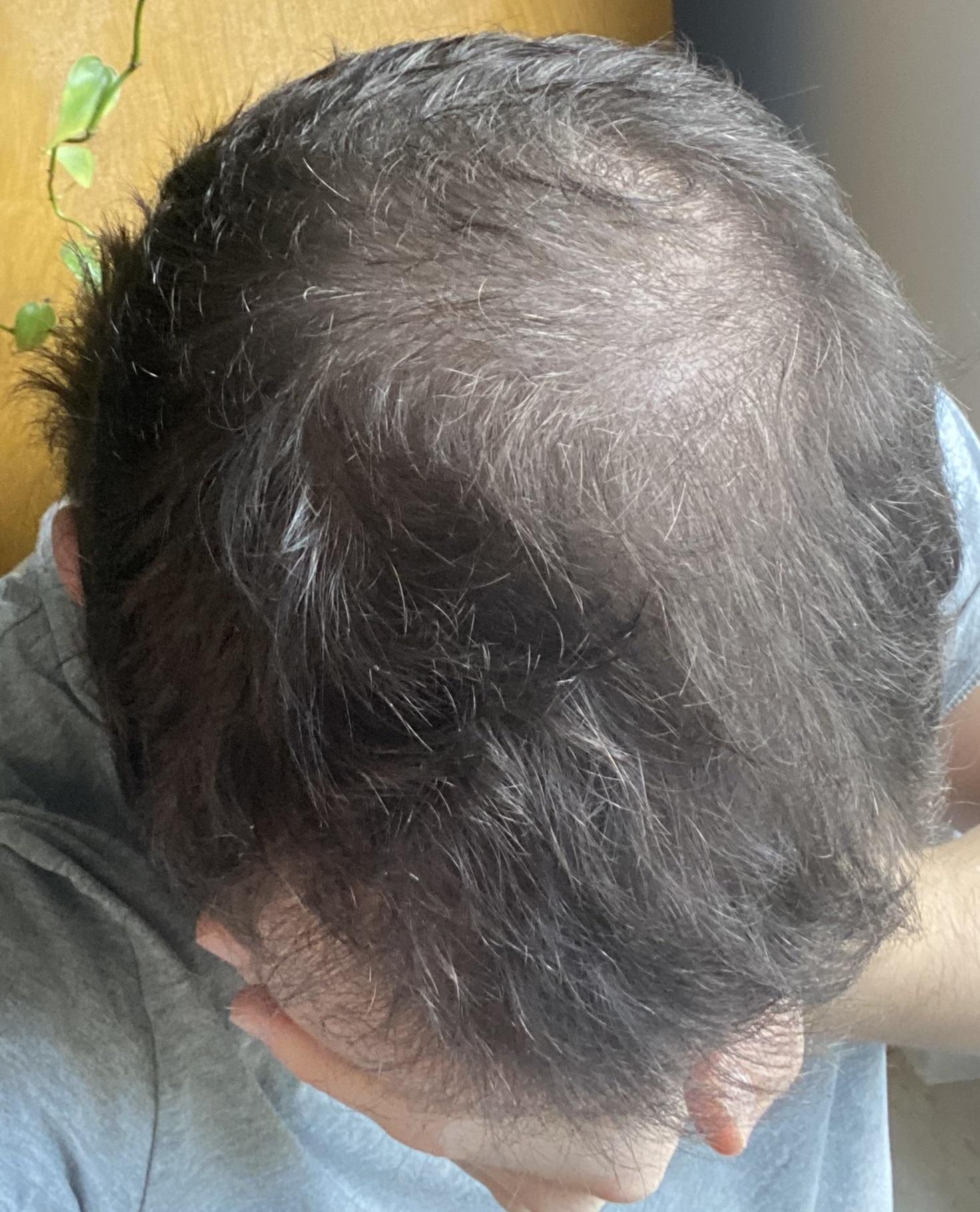 /foren/transplant/index.php/fa/56200/0/