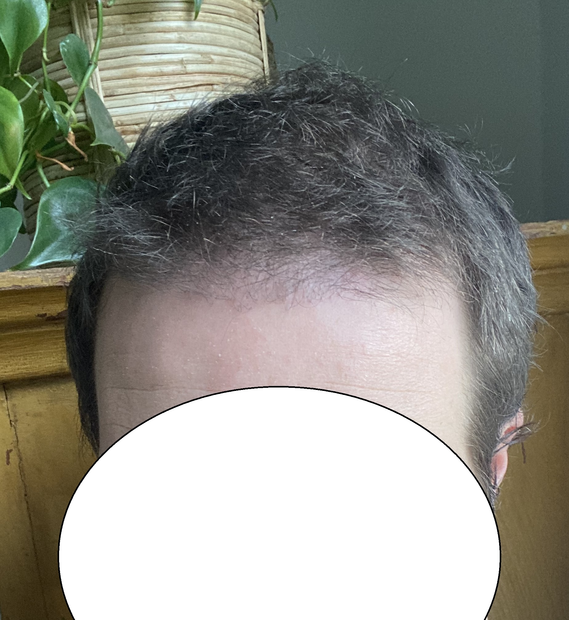 /foren/transplant/index.php/fa/56201/0/