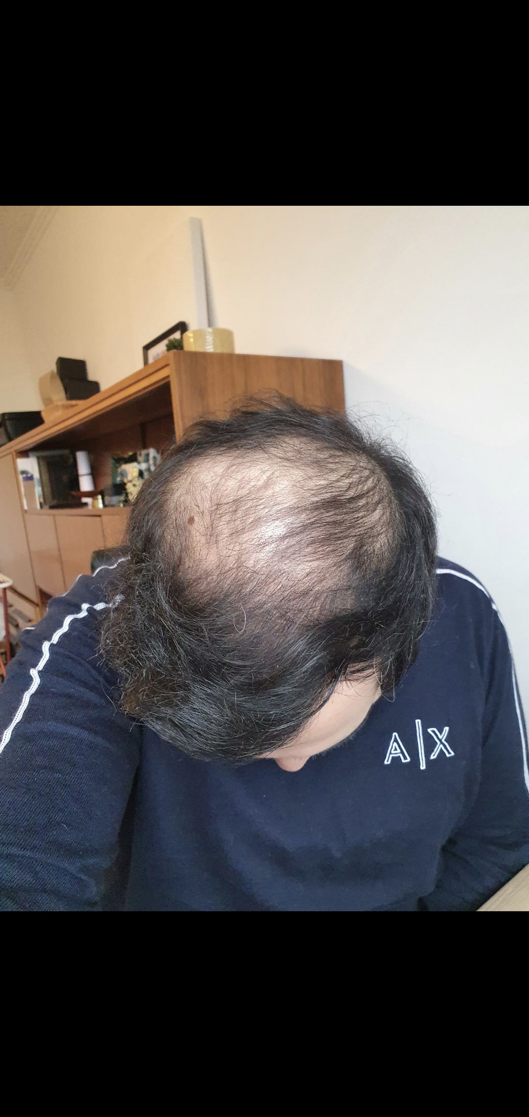 /foren/transplant/index.php/fa/56246/0/