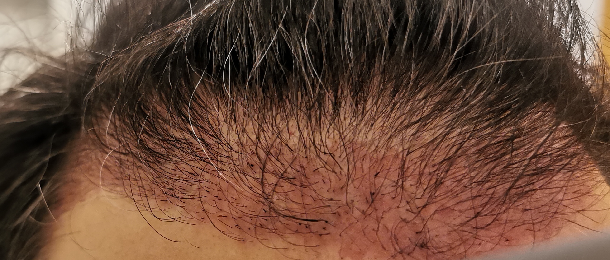 /foren/transplant/index.php/fa/56272/0/