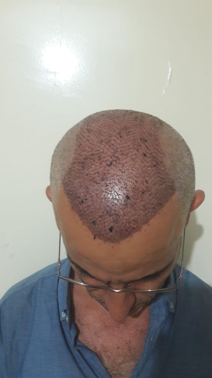 /foren/transplant/index.php/fa/56286/0/