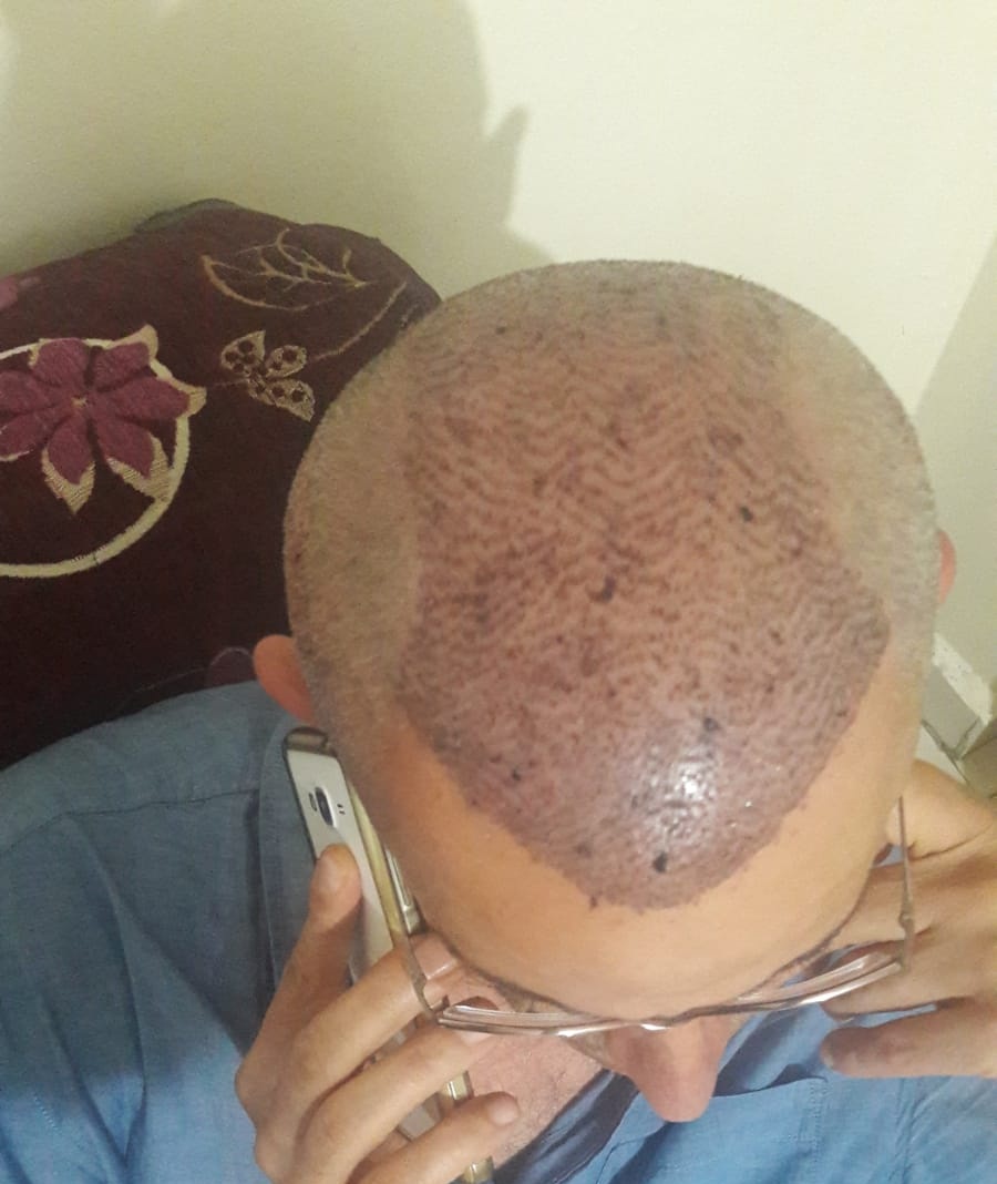 /foren/transplant/index.php/fa/56287/0/