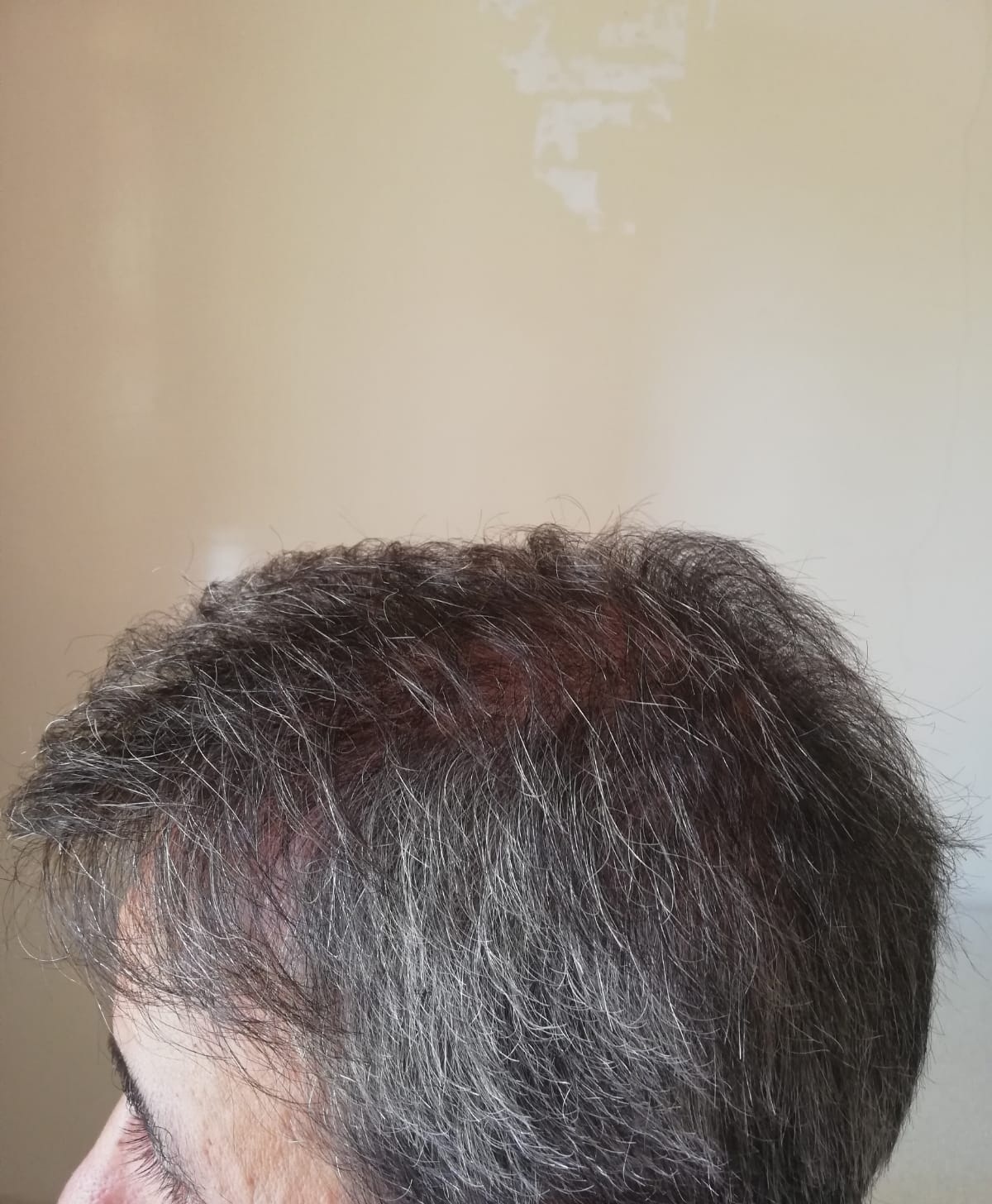 /foren/transplant/index.php/fa/56288/0/