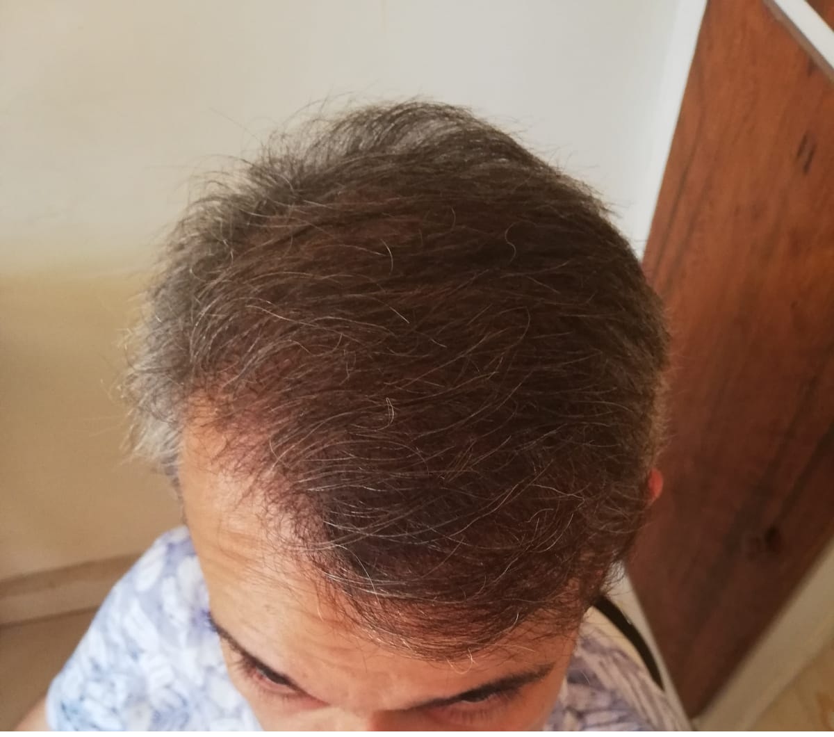 /foren/transplant/index.php/fa/56289/0/