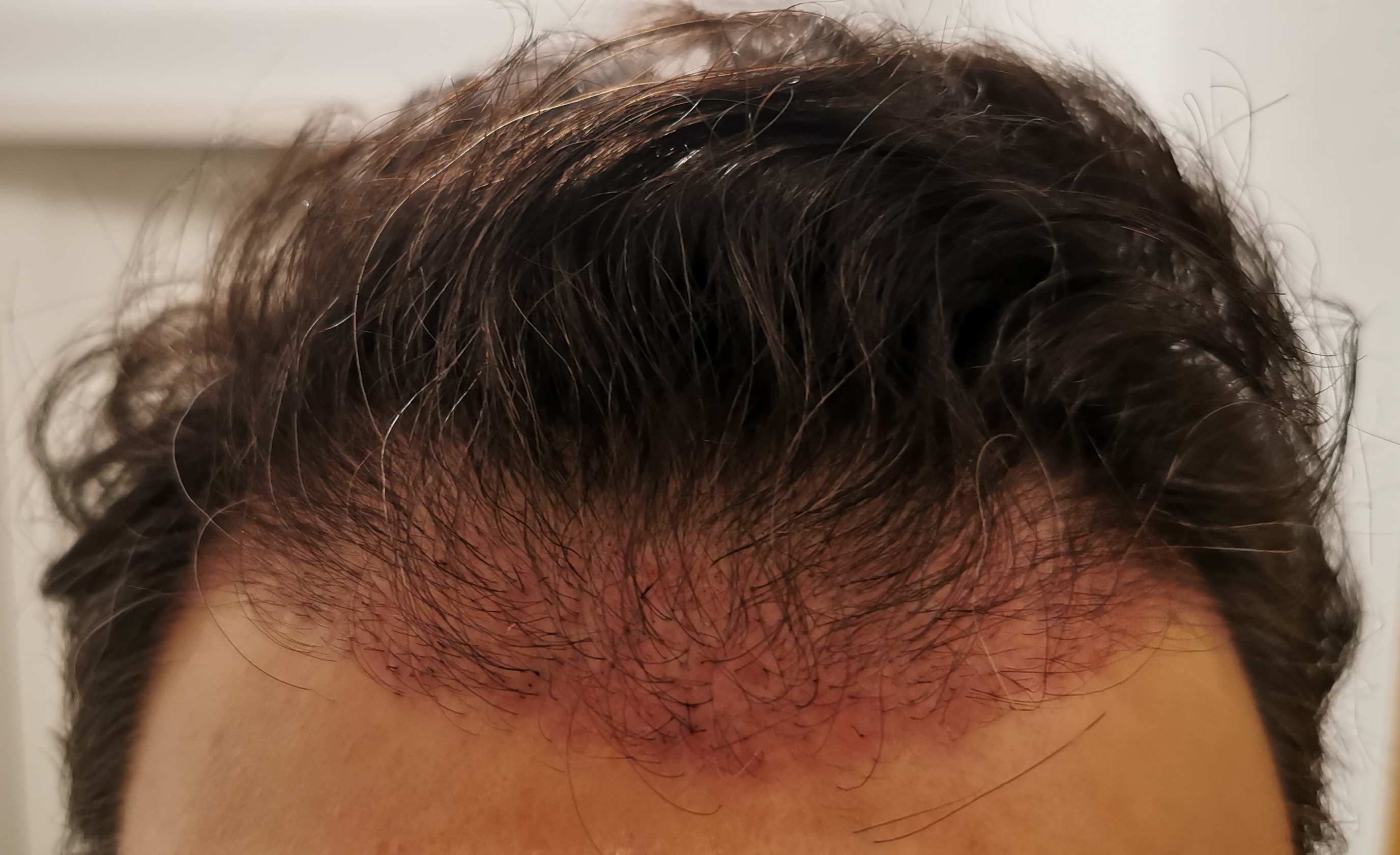 /foren/transplant/index.php/fa/56297/0/