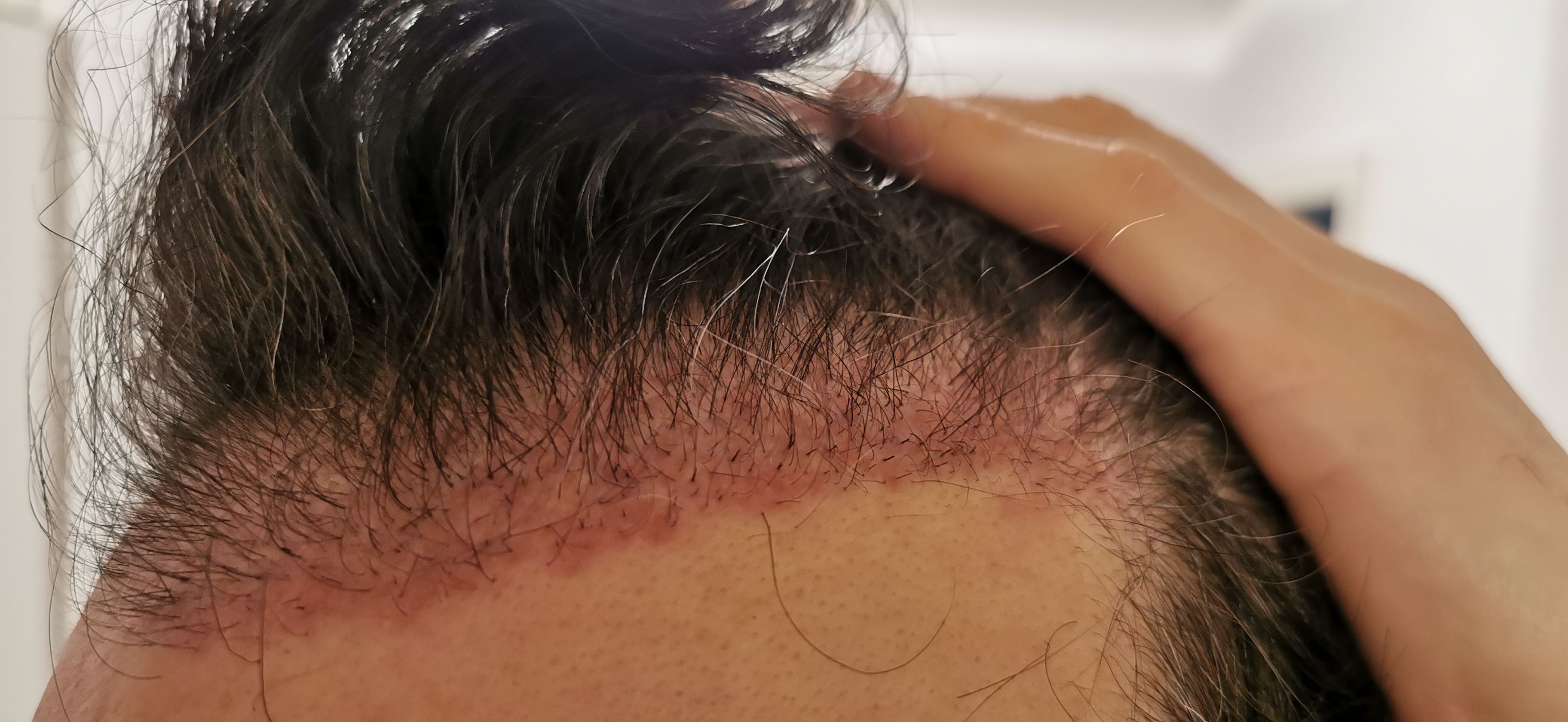 /foren/transplant/index.php/fa/56304/0/