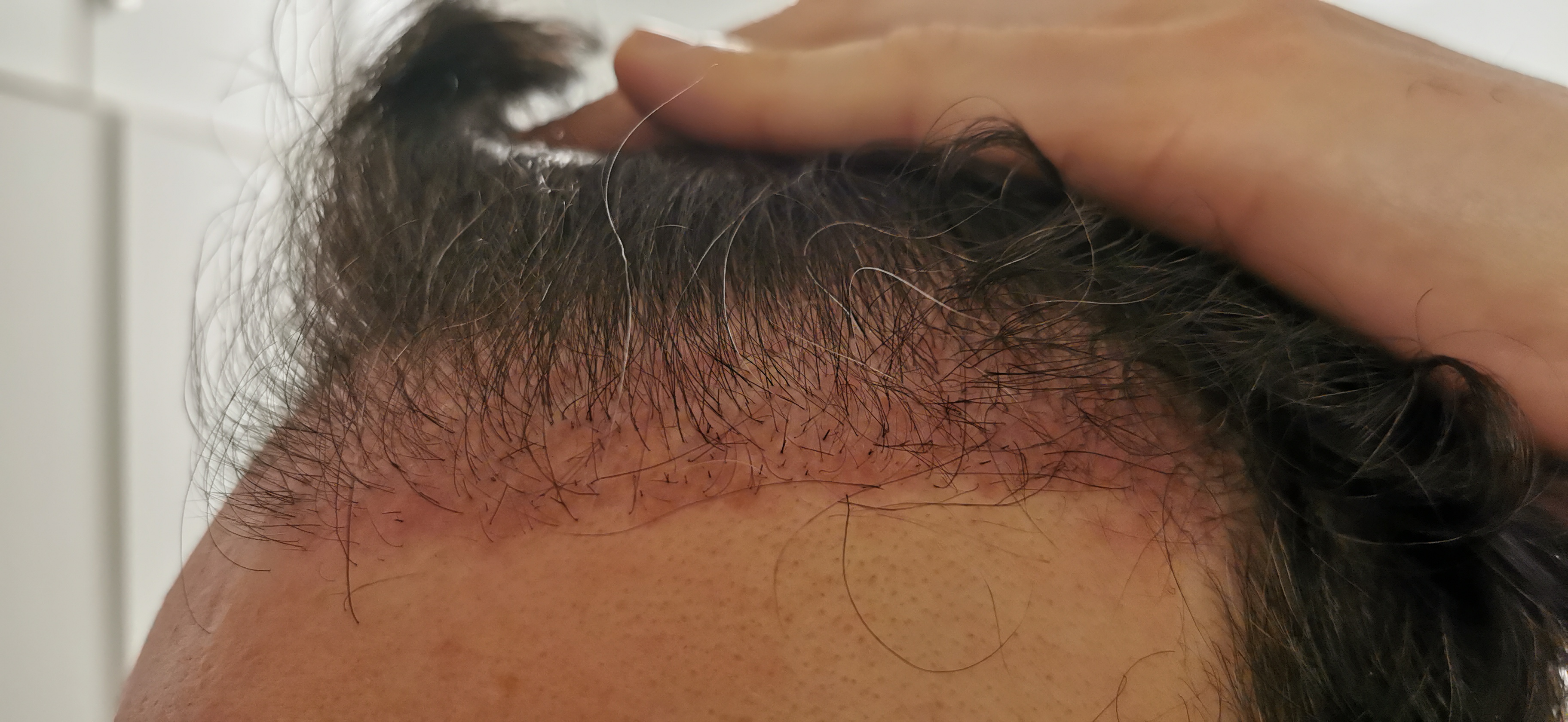 /foren/transplant/index.php/fa/56305/0/