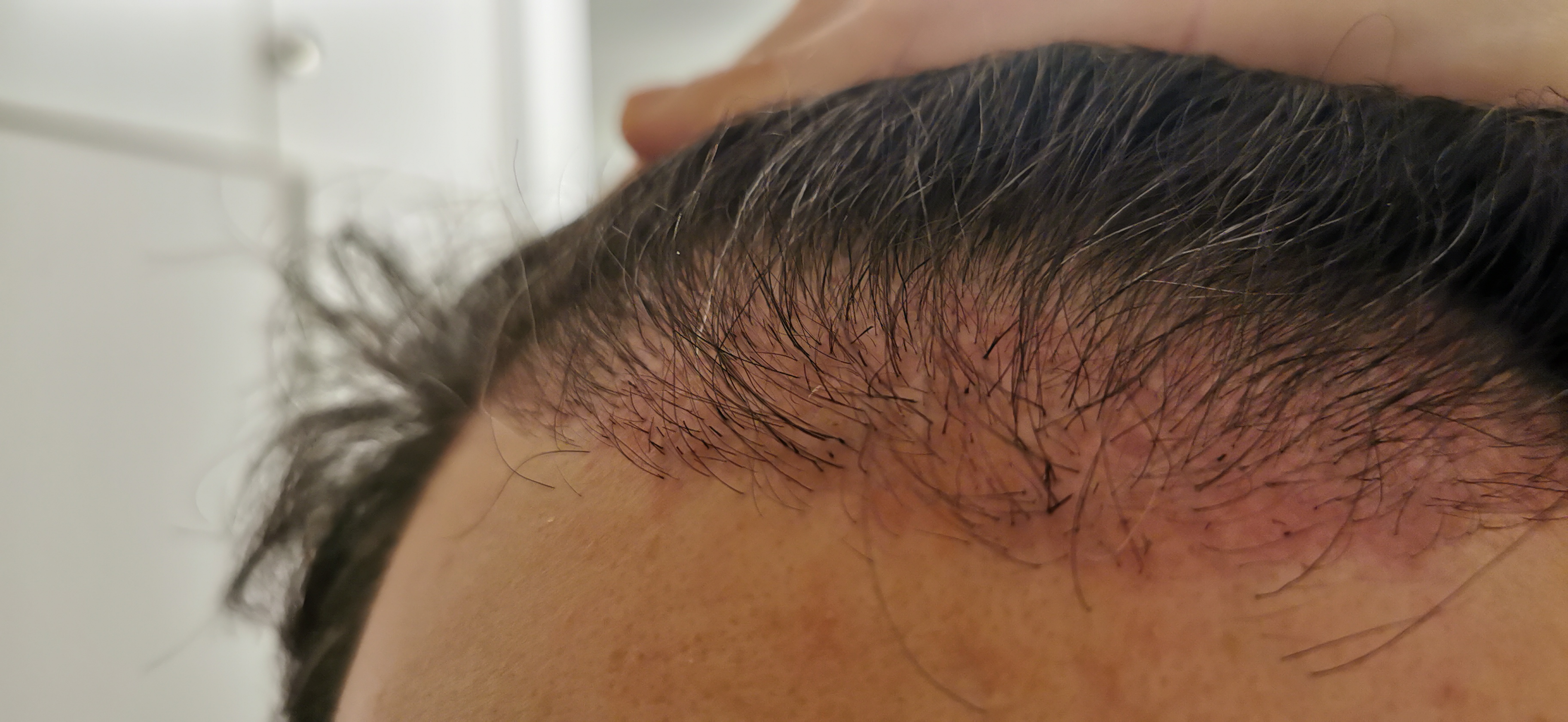 /foren/transplant/index.php/fa/56306/0/