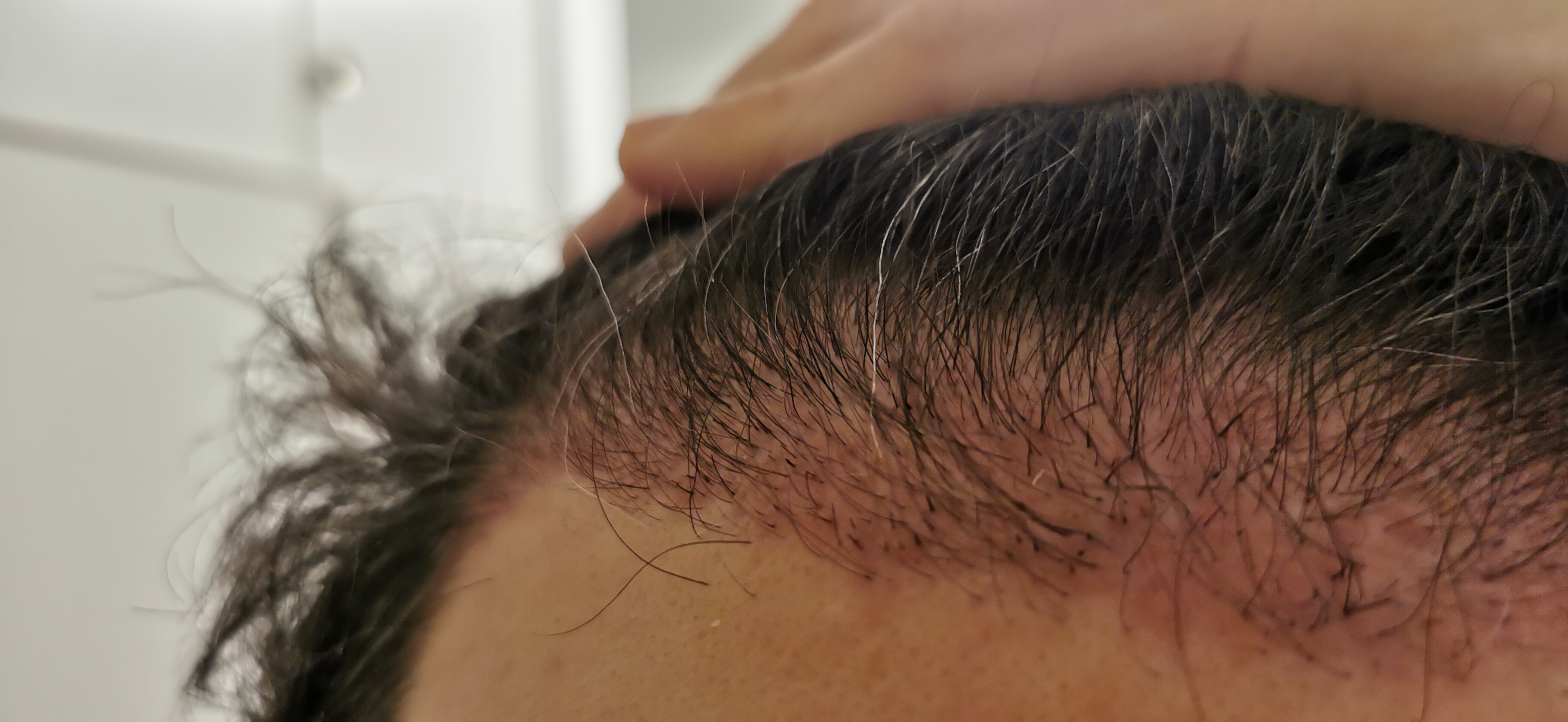 /foren/transplant/index.php/fa/56307/0/