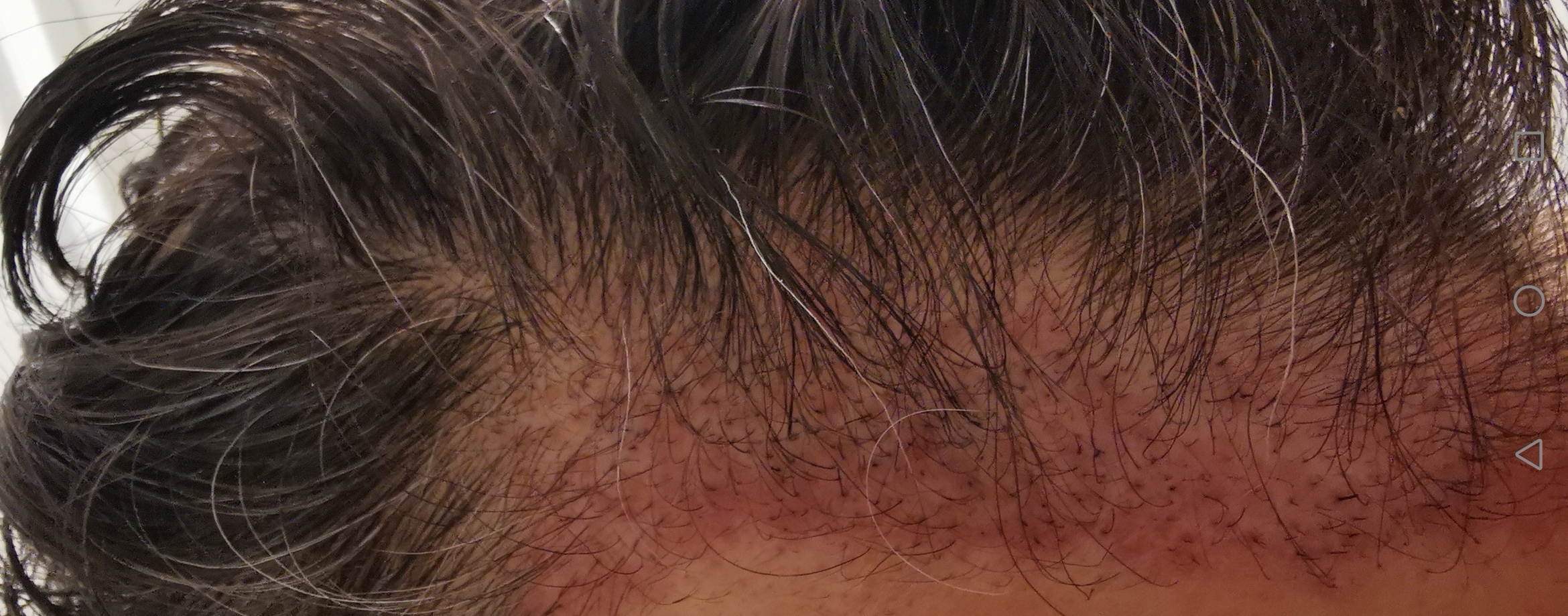 /foren/transplant/index.php/fa/56308/0/