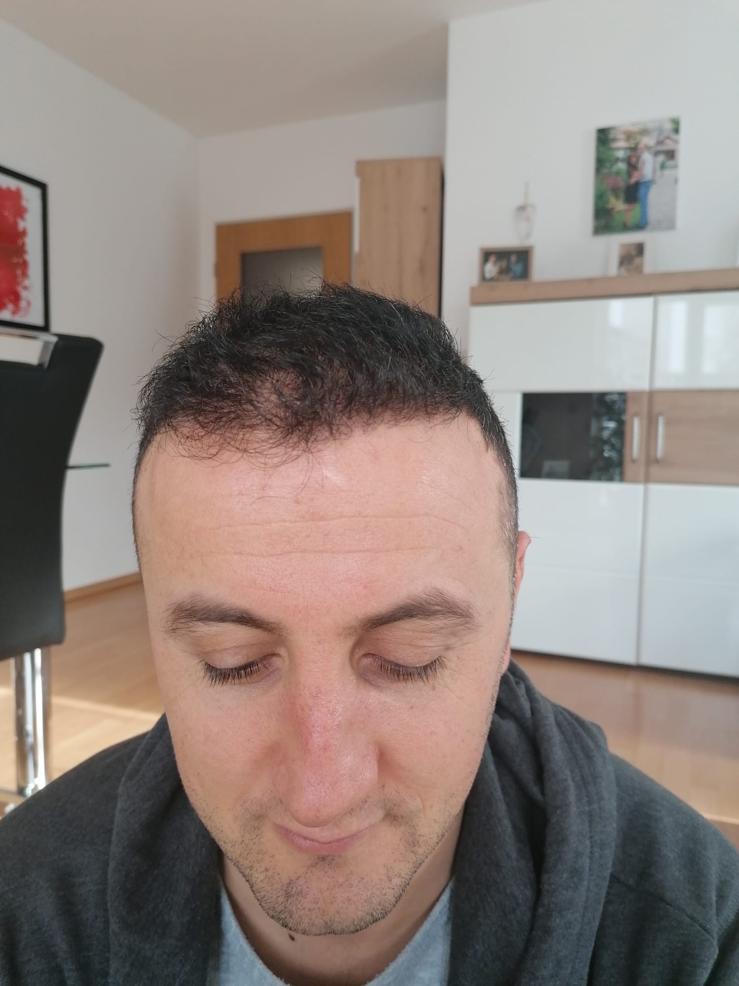 /foren/transplant/index.php/fa/56309/0/