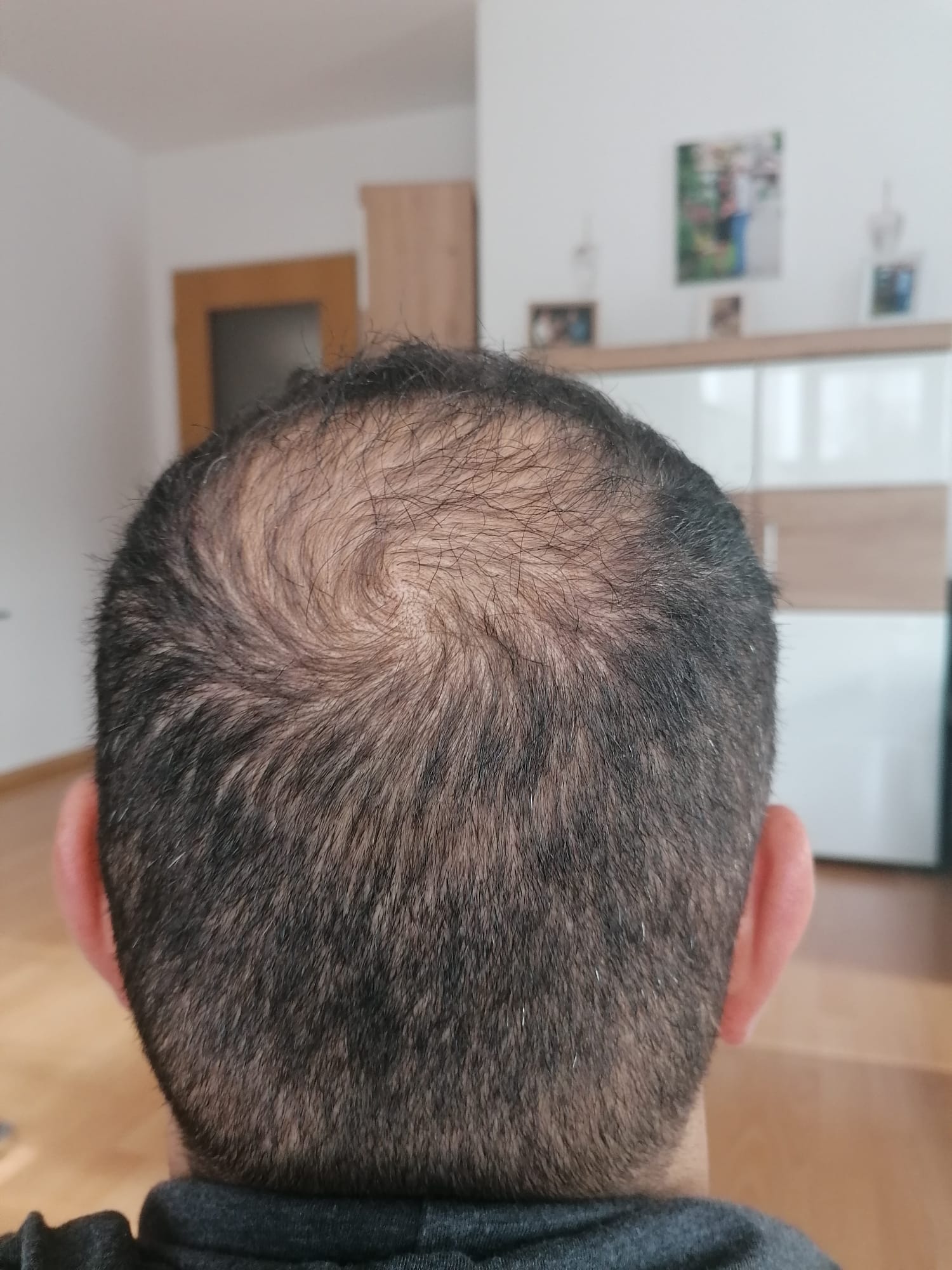 /foren/transplant/index.php/fa/56311/0/