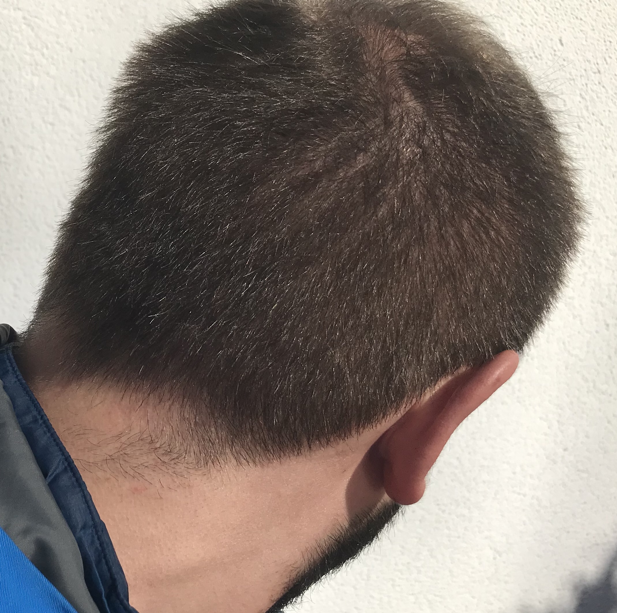 /foren/transplant/index.php/fa/56317/0/