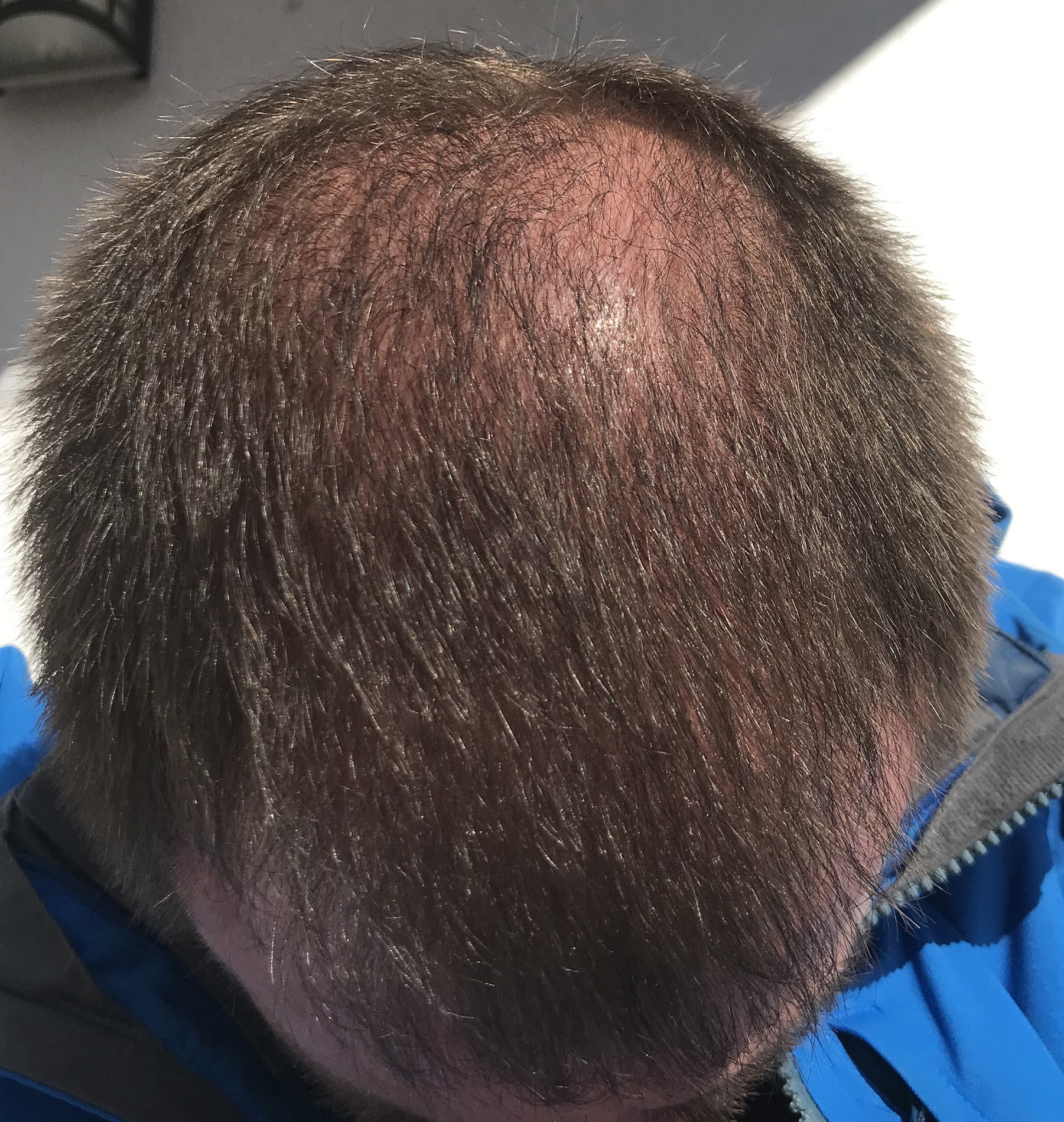 /foren/transplant/index.php/fa/56318/0/