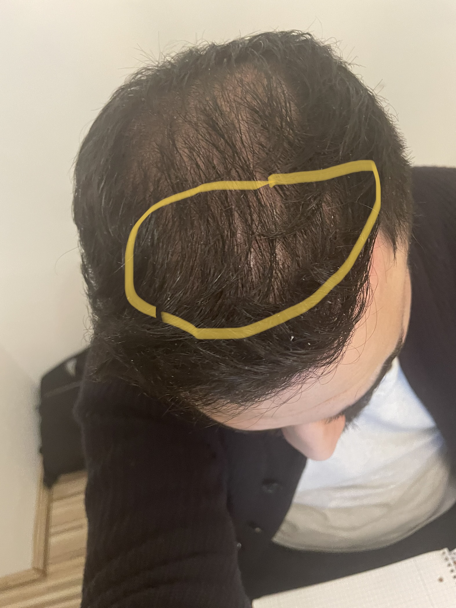 /foren/transplant/index.php/fa/56482/0/