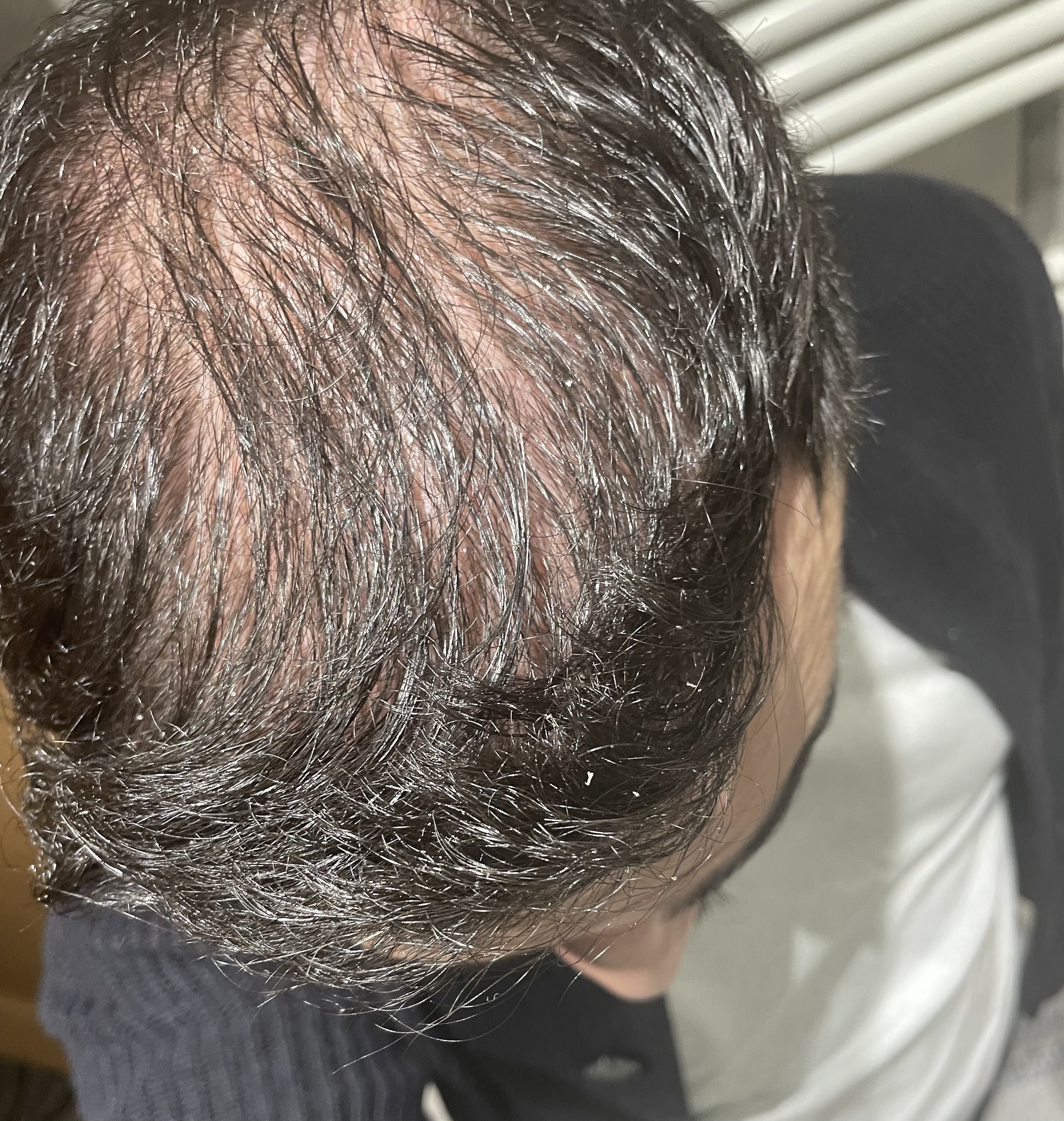 /foren/transplant/index.php/fa/56483/0/