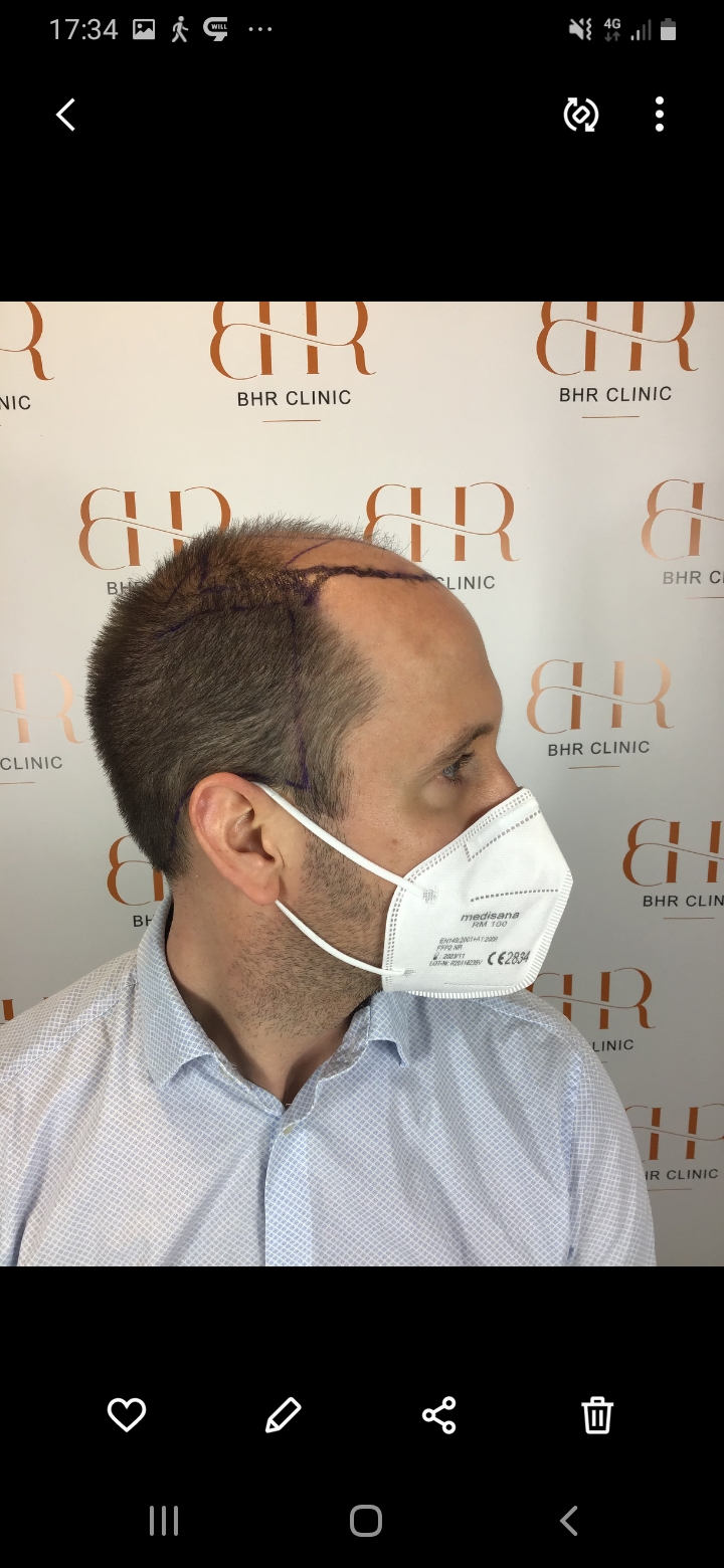 /foren/transplant/index.php/fa/56513/0/