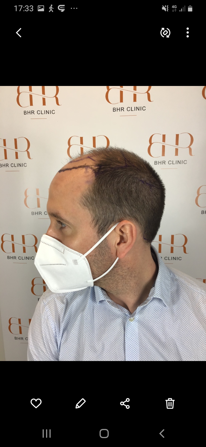 /foren/transplant/index.php/fa/56514/0/